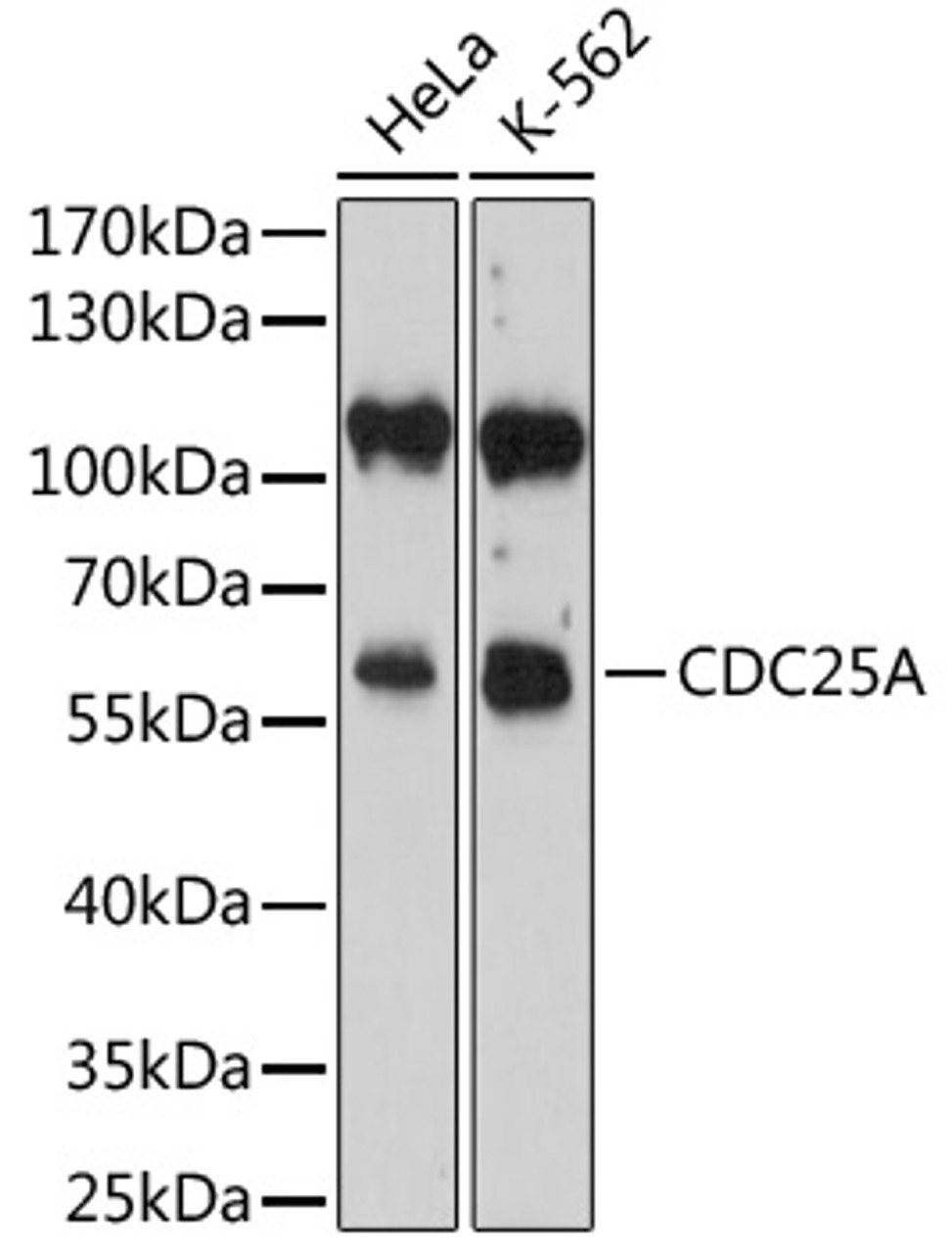 Western blot analysis of extracts of various cell lines, using CDC25A antibody (14-120) at 1:800 dilution.<br/>Secondary antibody: HRP Goat Anti-Rabbit IgG (H+L) at 1:10000 dilution.<br/>Lysates/proteins: 25ug per lane.<br/>Blocking buffer: 3% nonfat dry milk in TBST.<br/>Detection: ECL Basic Kit.<br/>Exposure time: 90s.