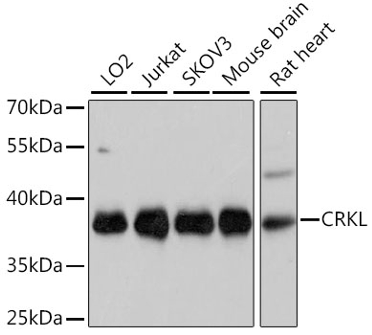 Western blot analysis of extracts of various cell lines, using CRKL Antibody (14-122) at 1:1000 dilution.<br/>Secondary antibody: HRP Goat Anti-Rabbit IgG (H+L) at 1:10000 dilution.<br/>Lysates/proteins: 25ug per lane.<br/>Blocking buffer: 3% nonfat dry milk in TBST.<br/>Detection: ECL Basic Kit.<br/>Exposure time: 30s.