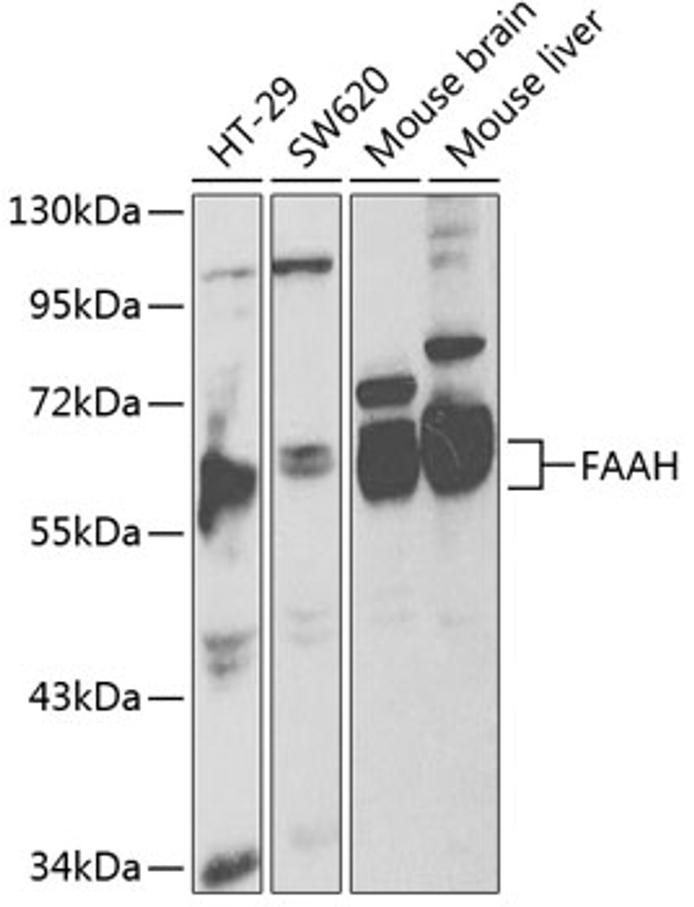 Western blot analysis of extracts of various cell lines, using FAAH antibody (14-124) at 1:1000 dilution.<br/>Secondary antibody: HRP Goat Anti-Rabbit IgG (H+L) at 1:10000 dilution.<br/>Lysates/proteins: 25ug per lane.<br/>Blocking buffer: 3% nonfat dry milk in TBST.