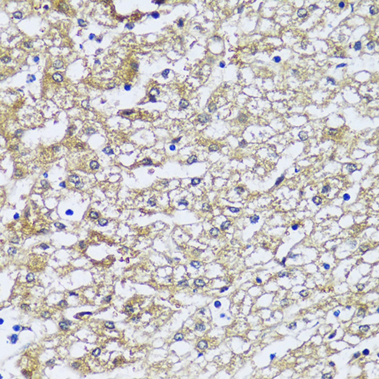 Immunohistochemistry of paraffin-embedded Human liver using NQO2 antibody (14-126) at dilution of 1:100 (40x lens) .