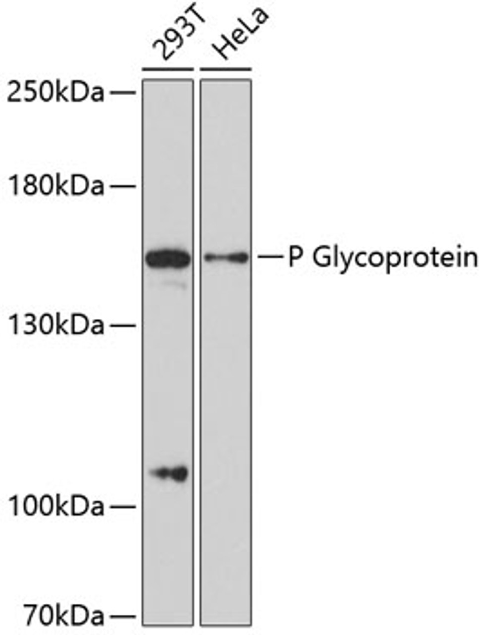 Western blot analysis of extracts of various cell lines, using P Glycoprotein antibody (14-127) at 1:3000 dilution.<br/>Secondary antibody: HRP Goat Anti-Rabbit IgG (H+L) at 1:10000 dilution.<br/>Lysates/proteins: 25ug per lane.<br/>Blocking buffer: 3% nonfat dry milk in TBST.<br/>Detection: ECL Basic Kit.<br/>Exposure time: 90s.