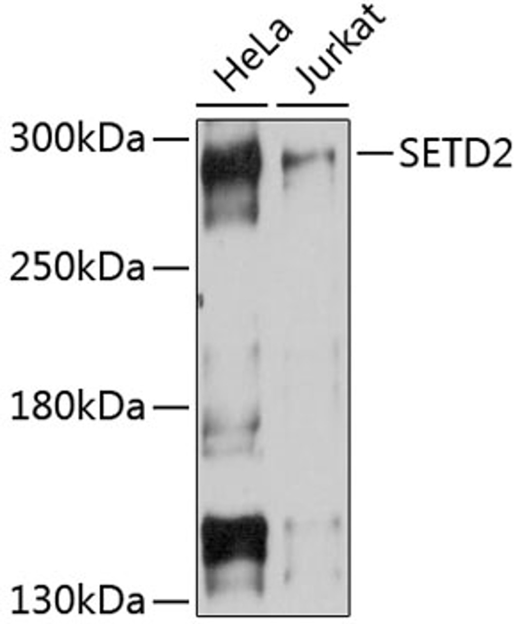 Western blot analysis of extracts of various cell lines, using SETD2 Antibody (14-132) at 1:1000 dilution.<br/>Secondary antibody: HRP Goat Anti-Rabbit IgG (H+L) at 1:10000 dilution.<br/>Lysates/proteins: 25ug per lane.<br/>Blocking buffer: 3% nonfat dry milk in TBST.<br/>Detection: ECL Basic Kit.<br/>Exposure time: 15s.