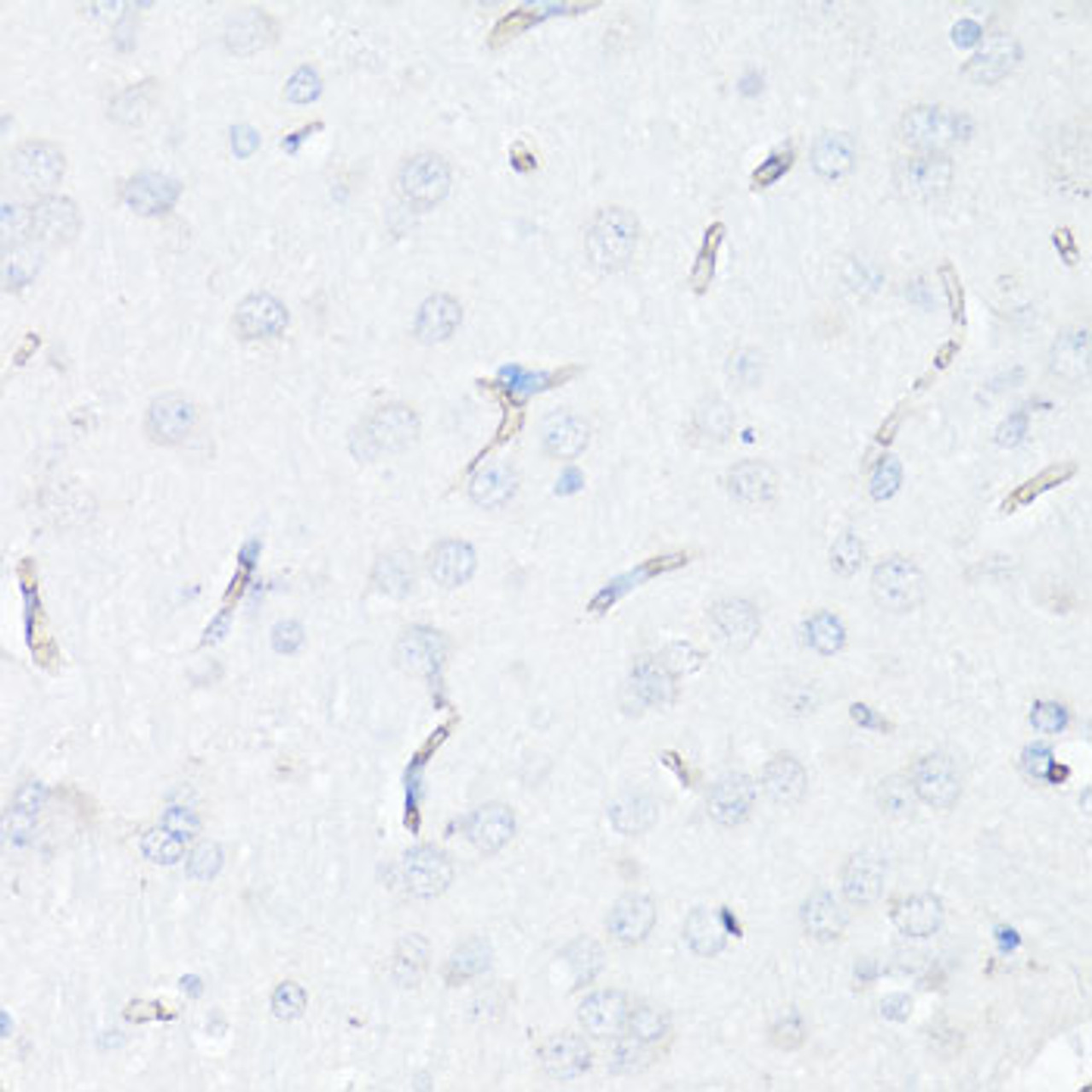 Immunohistochemistry of paraffin-embedded rat brain endothelial cells using P Glycoprotein antibody (14-133) at dilution of 1:100 (40x lens) .