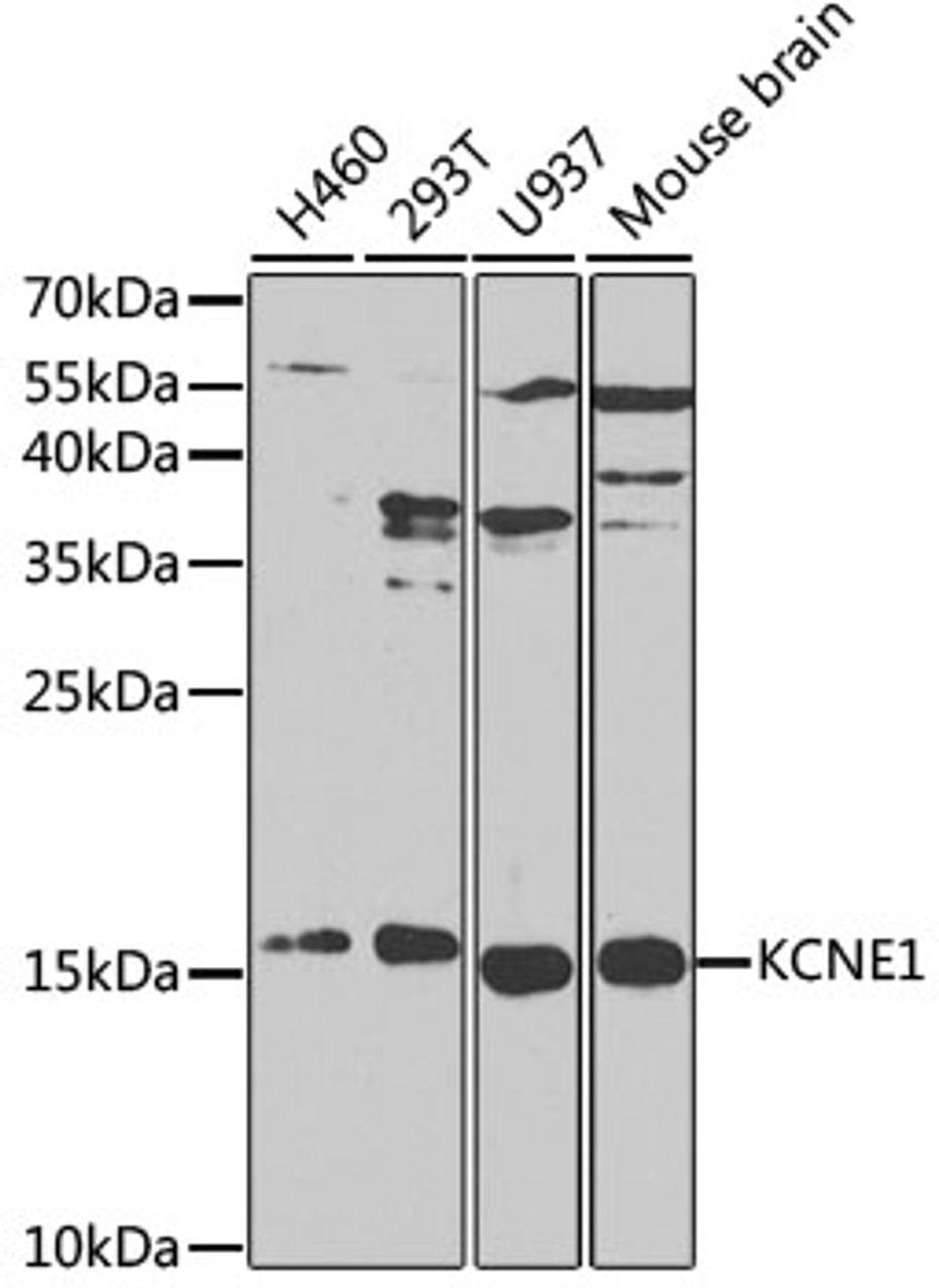 Western blot analysis of extracts of various cell lines, using KCNE1 antibody (14-135) at 1:1000 dilution.<br/>Secondary antibody: HRP Goat Anti-Rabbit IgG (H+L) at 1:10000 dilution.<br/>Lysates/proteins: 25ug per lane.<br/>Blocking buffer: 3% nonfat dry milk in TBST.<br/>Detection: ECL Basic Kit.<br/>Exposure time: 90s.