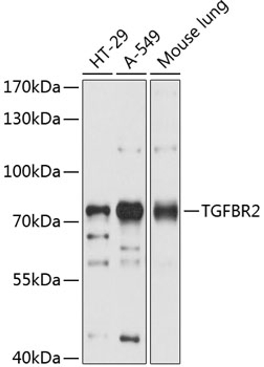 Western blot analysis of extracts of various cell lines, using TGFBR2 antibody (14-136) at 1:1000 dilution.<br/>Secondary antibody: HRP Goat Anti-Rabbit IgG (H+L) at 1:10000 dilution.<br/>Lysates/proteins: 25ug per lane.<br/>Blocking buffer: 3% nonfat dry milk in TBST.<br/>Detection: ECL Basic Kit.<br/>Exposure time: 1s.