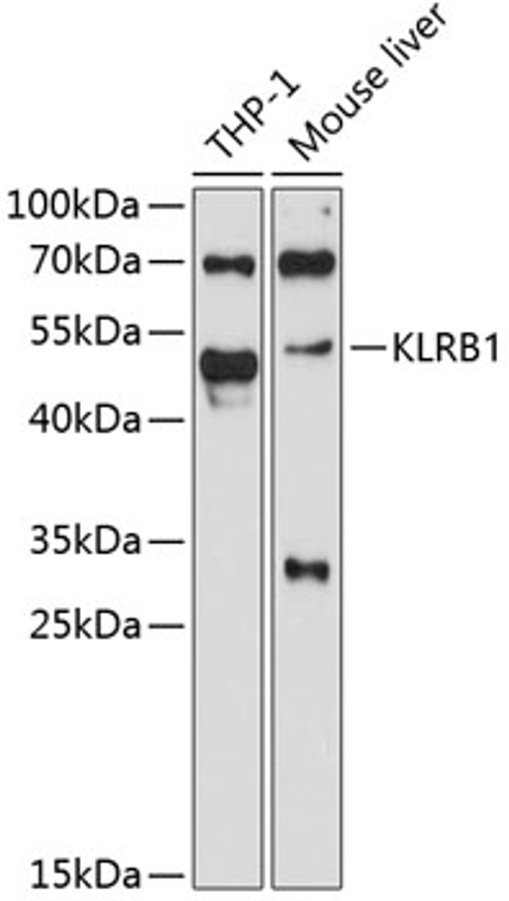 Western blot analysis of extracts of various cell lines, using KLRB1 antibody (14-141) at 1:3000 dilution.<br/>Secondary antibody: HRP Goat Anti-Rabbit IgG (H+L) at 1:10000 dilution.<br/>Lysates/proteins: 25ug per lane.<br/>Blocking buffer: 3% nonfat dry milk in TBST.<br/>Detection: ECL Basic Kit.<br/>Exposure time: 90s.