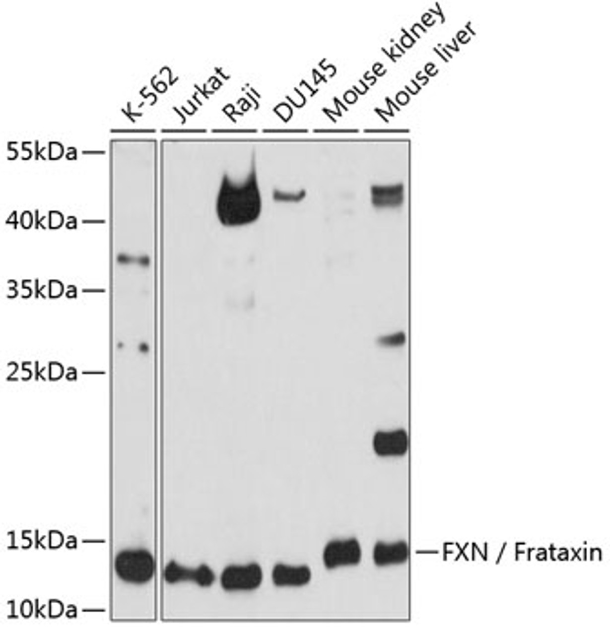 Western blot analysis of extracts of various cell lines, using FXN / Frataxin antibody (14-142) at 1:1000 dilution.<br/>Secondary antibody: HRP Goat Anti-Rabbit IgG (H+L) at 1:10000 dilution.<br/>Lysates/proteins: 25ug per lane.<br/>Blocking buffer: 3% nonfat dry milk in TBST.<br/>Detection: ECL Basic Kit.<br/>Exposure time: 10s.