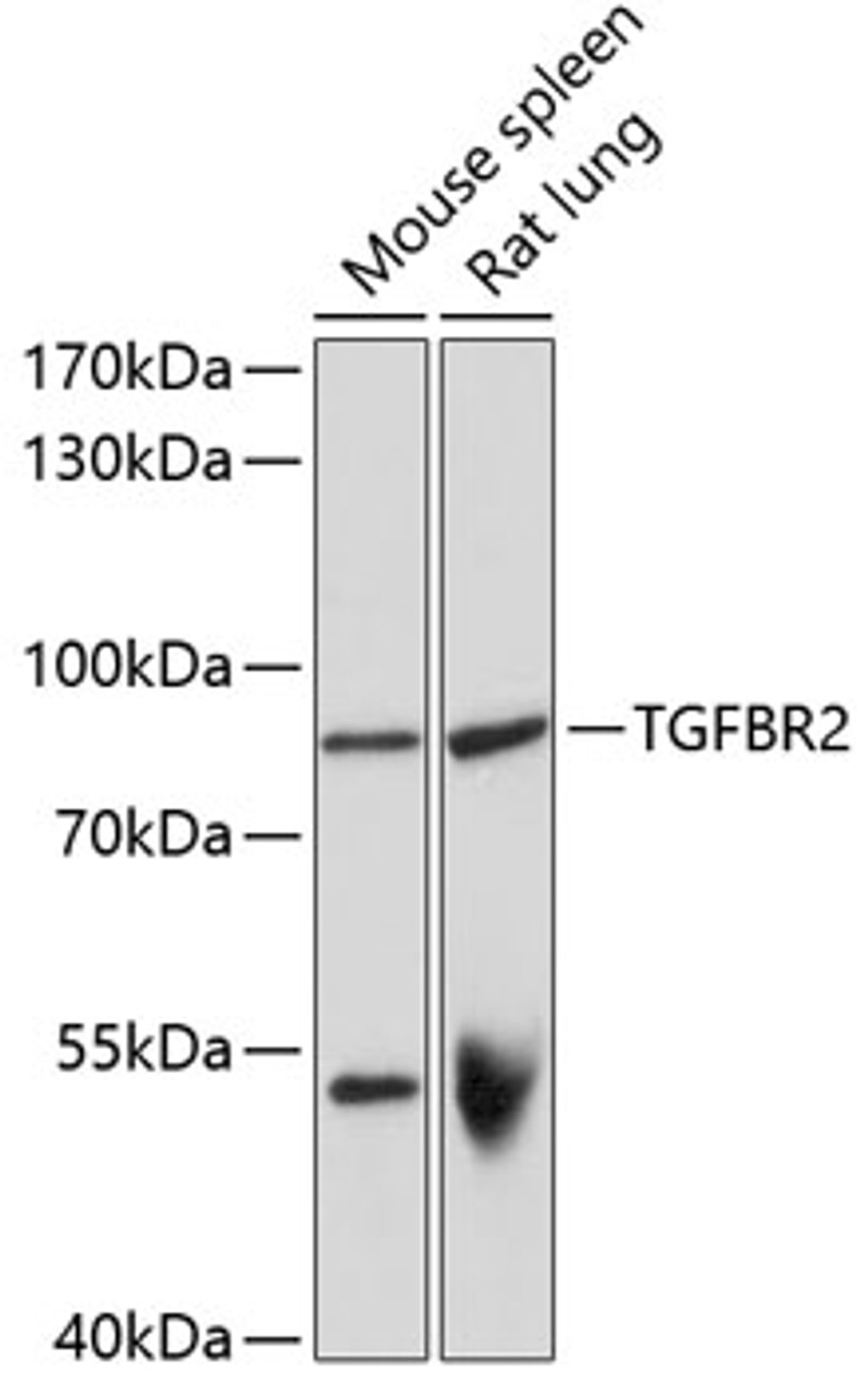 Western blot analysis of extracts of various cell lines, using TGFBR2 antibody (14-143) at 1:1000 dilution.<br/>Secondary antibody: HRP Goat Anti-Rabbit IgG (H+L) at 1:10000 dilution.<br/>Lysates/proteins: 25ug per lane.<br/>Blocking buffer: 3% nonfat dry milk in TBST.<br/>Detection: ECL Basic Kit.<br/>Exposure time: 1s.