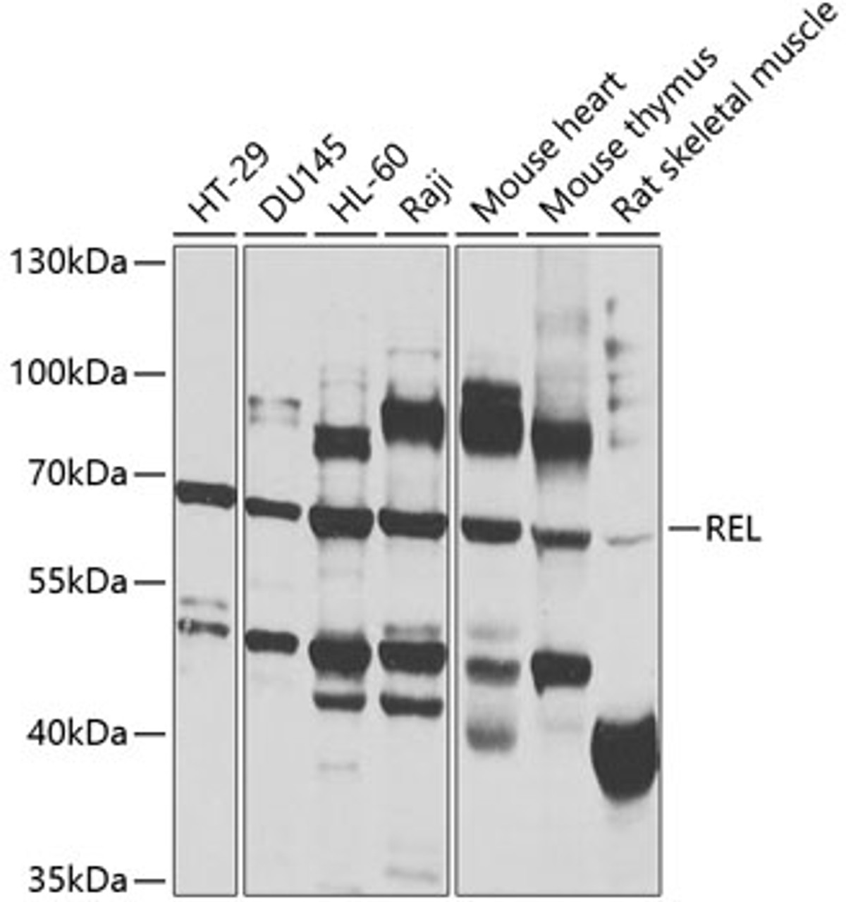 Western blot analysis of extracts of various cell lines, using REL antibody (14-150) at 1:1000 dilution.<br/>Secondary antibody: HRP Goat Anti-Rabbit IgG (H+L) at 1:10000 dilution.<br/>Lysates/proteins: 25ug per lane.<br/>Blocking buffer: 3% nonfat dry milk in TBST.<br/>Detection: ECL Basic Kit.<br/>Exposure time: 90s.