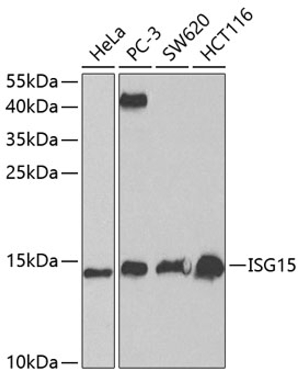 Western blot analysis of extracts of various cell lines, using ISG15 antibody (14-152) at 1:1000 dilution.<br/>Secondary antibody: HRP Goat Anti-Rabbit IgG (H+L) at 1:10000 dilution.<br/>Lysates/proteins: 25ug per lane.<br/>Blocking buffer: 3% nonfat dry milk in TBST.