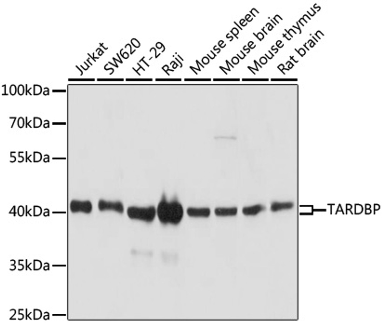 Immunohistochemistry of paraffin-embedded human esophagus using TARDBP Antibody (14-156) at dilution of 1:200 (40x lens) .