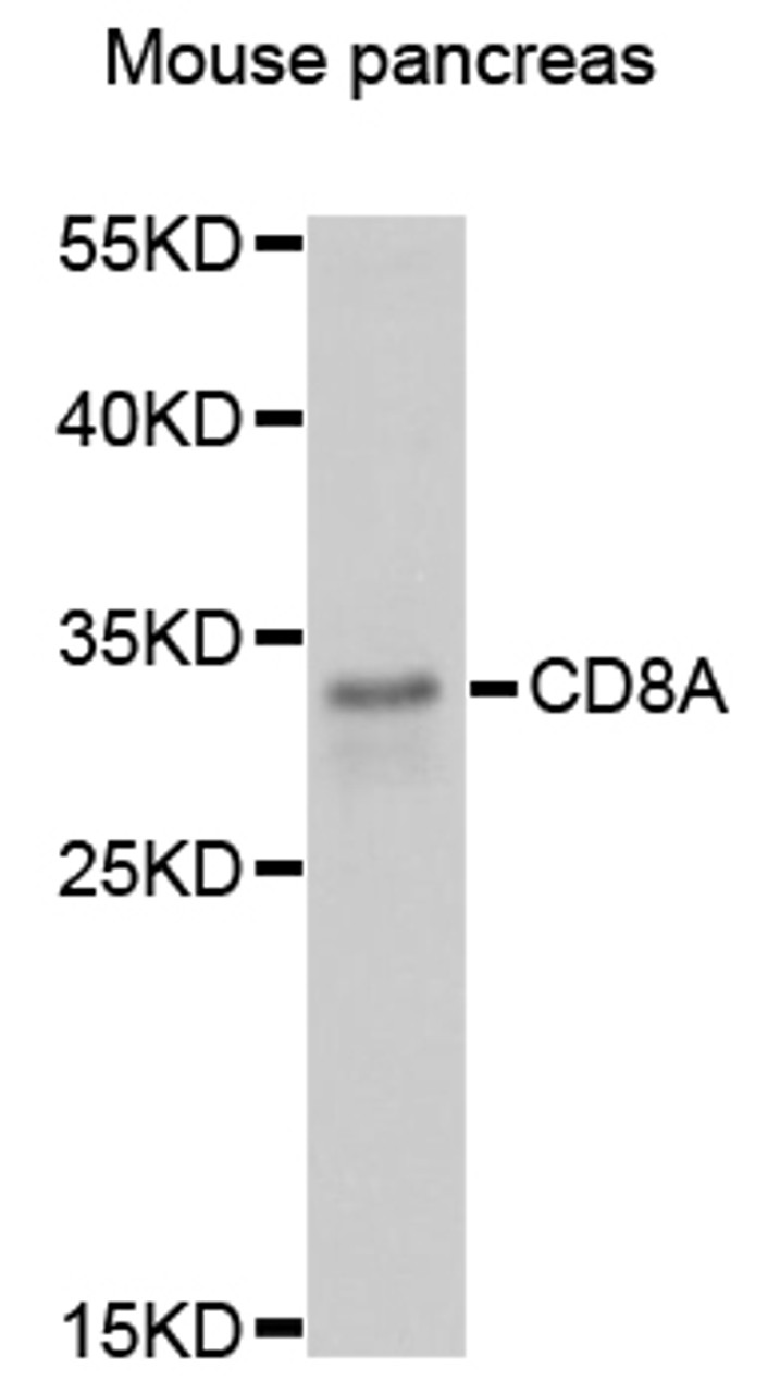 Western blot analysis of extracts of mouse pancreas, using CD8A antibody (14-172) at 1:3000 dilution.<br/>Secondary antibody: HRP Goat Anti-Rabbit IgG (H+L) at 1:10000 dilution.<br/>Lysates/proteins: 25ug per lane.<br/>Blocking buffer: 3% nonfat dry milk in TBST.<br/>Detection: ECL Basic Kit.<br/>Exposure time: 90s.