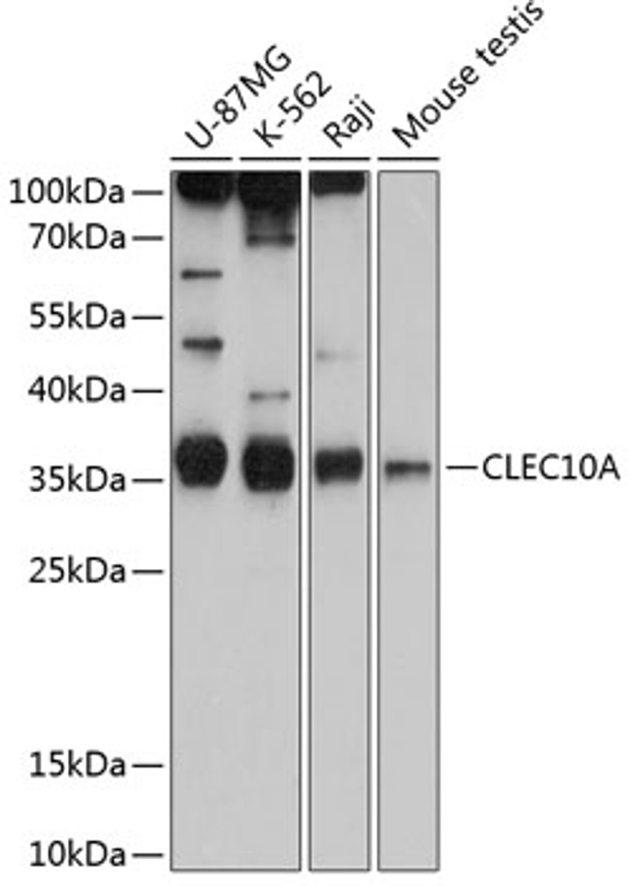 Western blot analysis of extracts of various cell lines, using CLEC10A antibody (14-173) at 1:1000 dilution.<br/>Secondary antibody: HRP Goat Anti-Rabbit IgG (H+L) at 1:10000 dilution.<br/>Lysates/proteins: 25ug per lane.<br/>Blocking buffer: 3% nonfat dry milk in TBST.<br/>Detection: ECL Basic Kit.<br/>Exposure time: 90s.