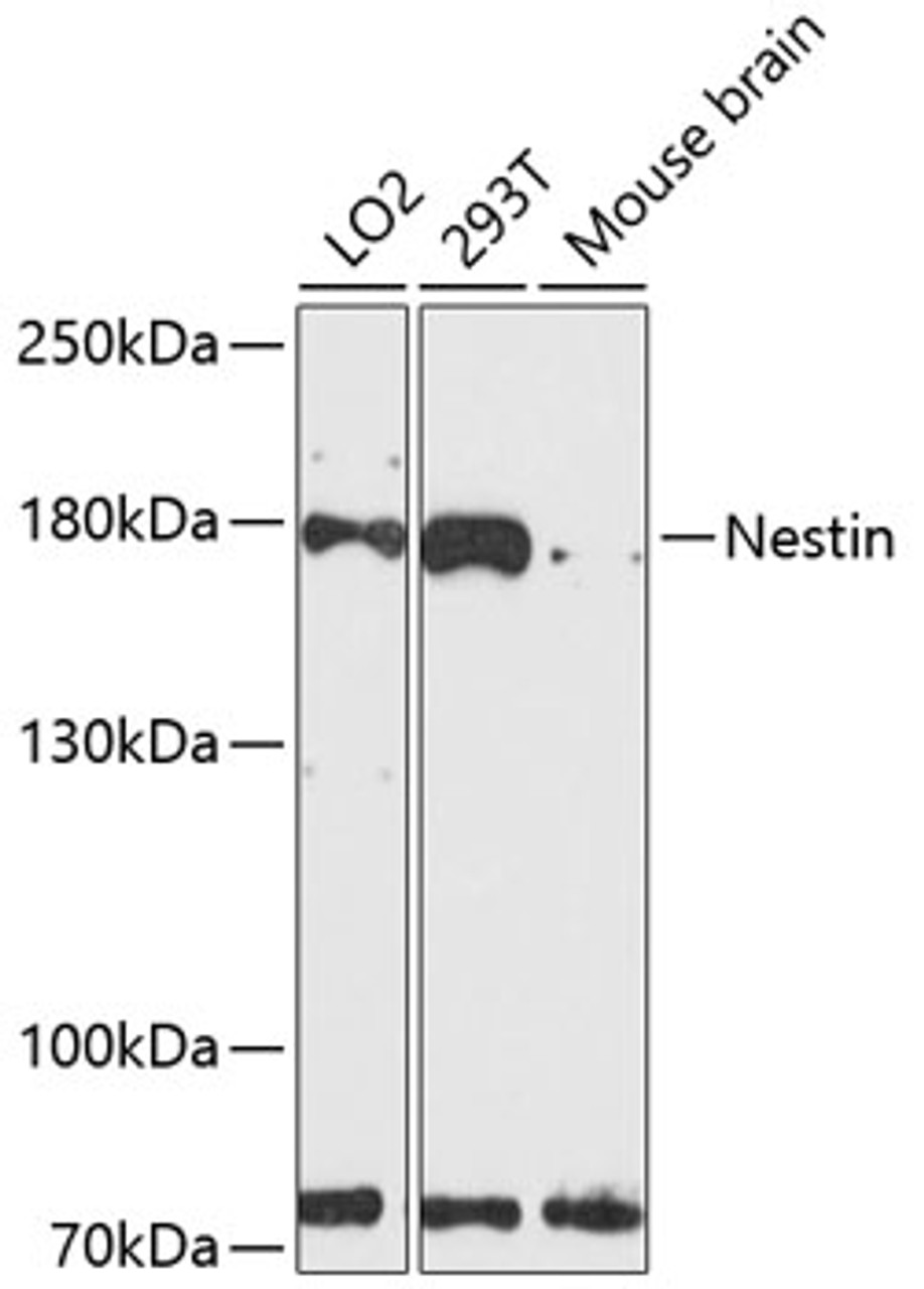 Western blot analysis of extracts of various cell lines, using Nestin antibody (14-175) at 1:3000 dilution.<br/>Secondary antibody: HRP Goat Anti-Rabbit IgG (H+L) at 1:10000 dilution.<br/>Lysates/proteins: 25ug per lane.<br/>Blocking buffer: 3% nonfat dry milk in TBST.<br/>Detection: ECL Basic Kit.<br/>Exposure time: 90s.