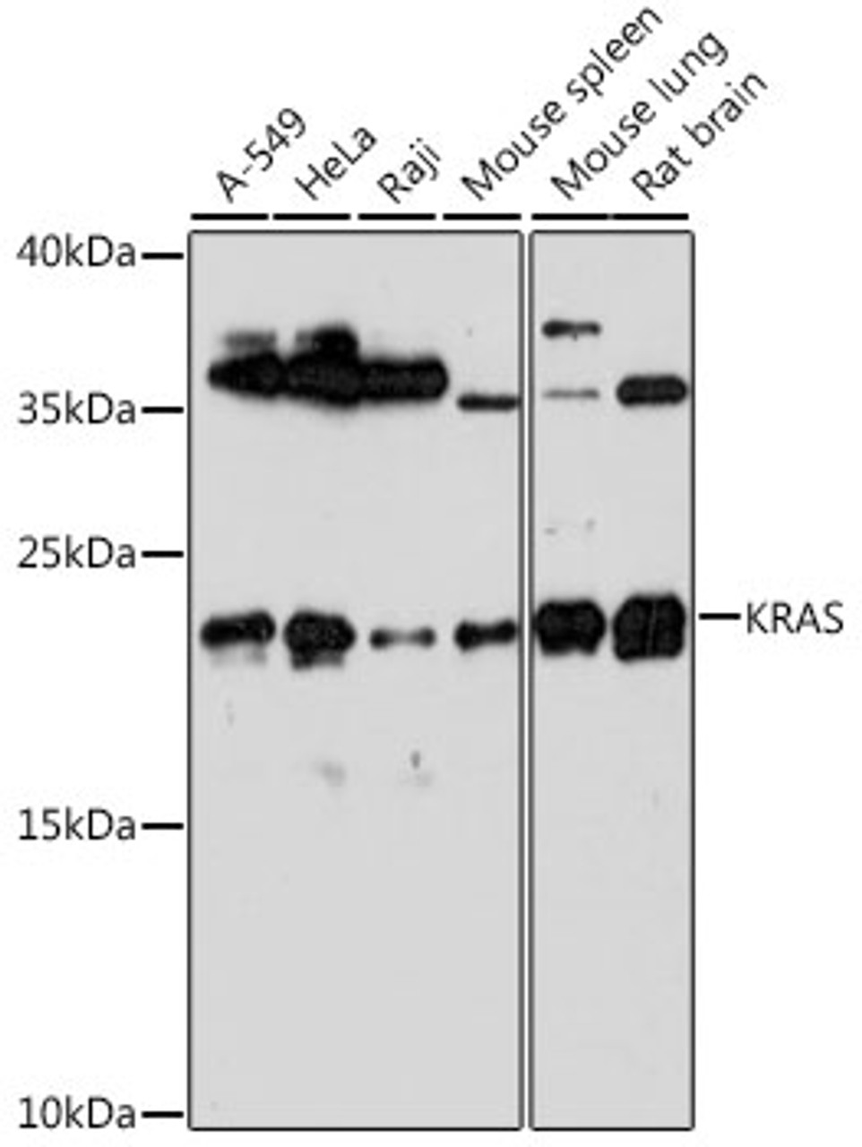 Western blot analysis of extracts of various cell lines, using KRAS antibody (14-182) at 1:1000 dilution.<br/>Secondary antibody: HRP Goat Anti-Rabbit IgG (H+L) at 1:10000 dilution.<br/>Lysates/proteins: 25ug per lane.<br/>Blocking buffer: 3% nonfat dry milk in TBST.<br/>Detection: ECL Basic Kit.<br/>Exposure time: 90s.