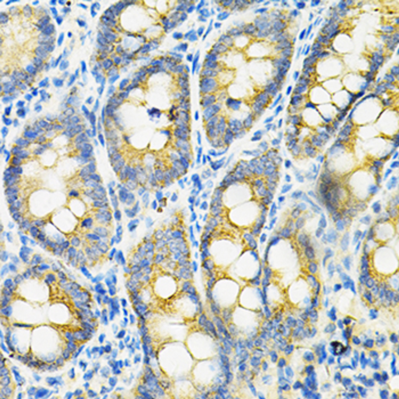 Immunohistochemistry of paraffin-embedded rat intestine using HGF antibody (14-198) at dilution of 1:100 (40x lens) .