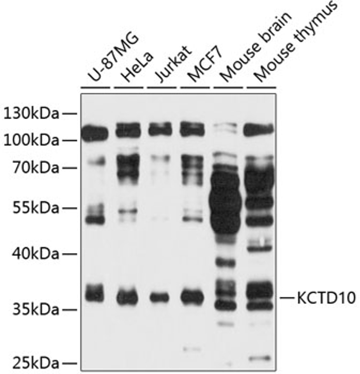 Western blot analysis of extracts of various cell lines, using KCTD10 antibody (14-202) at 1:3000 dilution.<br/>Secondary antibody: HRP Goat Anti-Rabbit IgG (H+L) at 1:10000 dilution.<br/>Lysates/proteins: 25ug per lane.<br/>Blocking buffer: 3% nonfat dry milk in TBST.<br/>Detection: ECL Basic Kit.<br/>Exposure time: 30s.