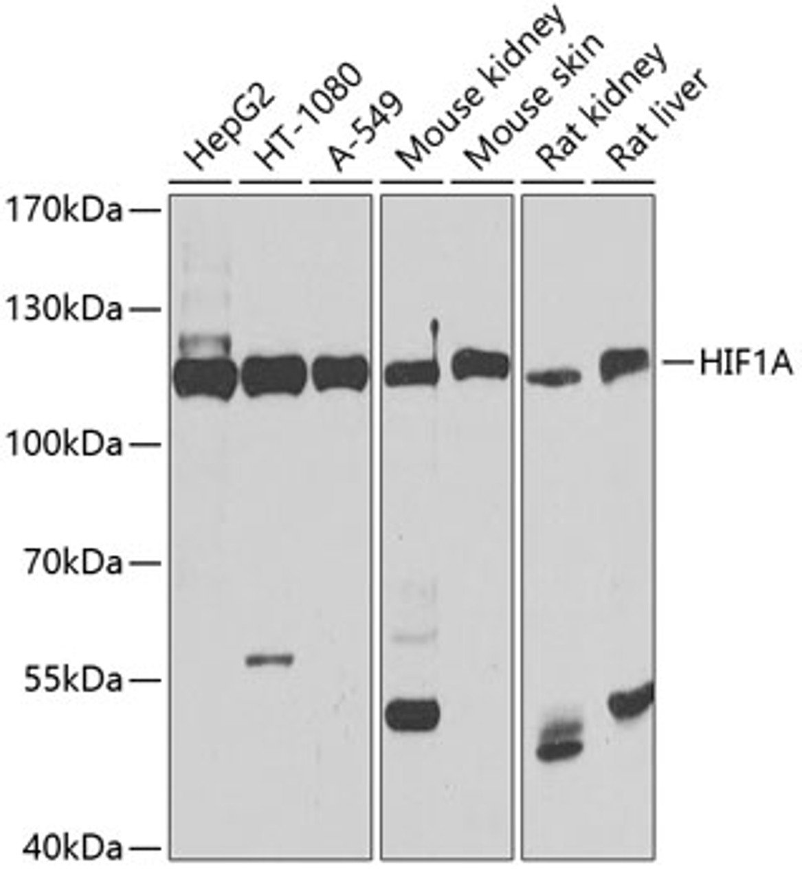 Western blot analysis of extracts of various cell lines, using HIF1A antibody (14-204) at 1:1000 dilution.<br/>Secondary antibody: HRP Goat Anti-Rabbit IgG (H+L) at 1:10000 dilution.<br/>Lysates/proteins: 25ug per lane.<br/>Blocking buffer: 3% nonfat dry milk in TBST.<br/>Detection: ECL Basic Kit.<br/>Exposure time: 90s.