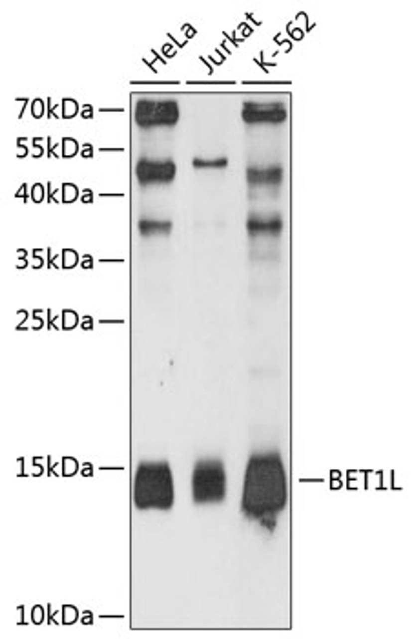 Western blot analysis of extracts of various cell lines, using BET1L antibody (14-205) at 1:3000 dilution._Secondary antibody: HRP Goat Anti-Rabbit IgG (H+L) at 1:10000 dilution._Lysates/proteins: 25ug per lane._Blocking buffer: 3% nonfat dry milk in TBST._Detection: ECL Enhanced Kit._Exposure time: 90s.