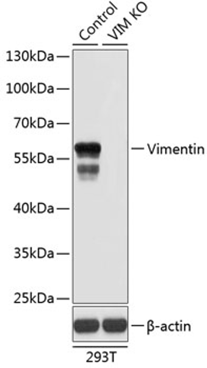 Western blot analysis of extracts from normal (control) and Vimentin knockout (KO) 293T cells, using Vimentin antibody (14-206) at 1:1000 dilution.<br/>Secondary antibody: HRP Goat Anti-Rabbit IgG (H+L) at 1:10000 dilution.<br/>Lysates/proteins: 25ug per lane.<br/>Blocking buffer: 3% nonfat dry milk in TBST.<br/>Detection: ECL Basic Kit.<br/>Exposure time: 10s.