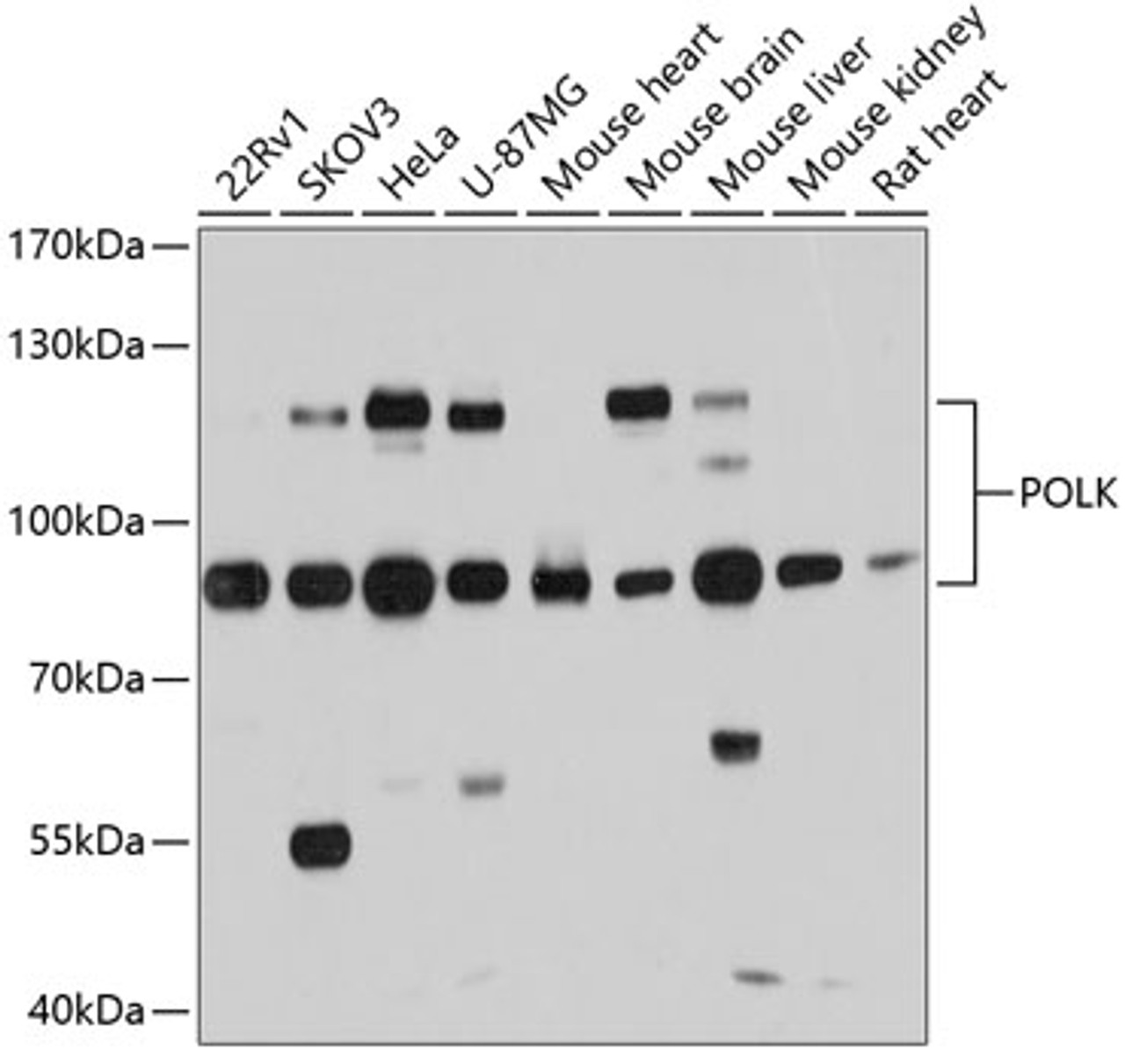 Western blot analysis of extracts of various cell lines, using POLK antibody (14-211) at 1:1000 dilution.<br/>Secondary antibody: HRP Goat Anti-Rabbit IgG (H+L) at 1:10000 dilution.<br/>Lysates/proteins: 25ug per lane.<br/>Blocking buffer: 3% nonfat dry milk in TBST.<br/>Detection: ECL Basic Kit.<br/>Exposure time: 5s.