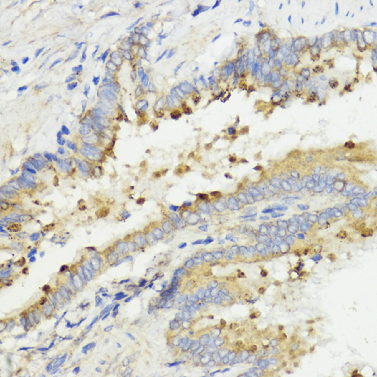 Immunohistochemistry of paraffin-embedded rat lung using IGF1 antibody (14-216) at dilution of 1:100 (40x lens) .