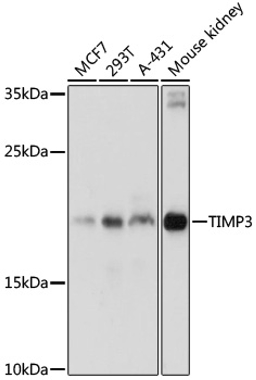 Western blot analysis of extracts of various cell lines, using TIMP3 antibody (14-217) at 1:1000 dilution.<br/>Secondary antibody: HRP Goat Anti-Rabbit IgG (H+L) at 1:10000 dilution.<br/>Lysates/proteins: 25ug per lane.<br/>Blocking buffer: 3% nonfat dry milk in TBST.<br/>Detection: ECL Basic Kit.<br/>Exposure time: 3min.