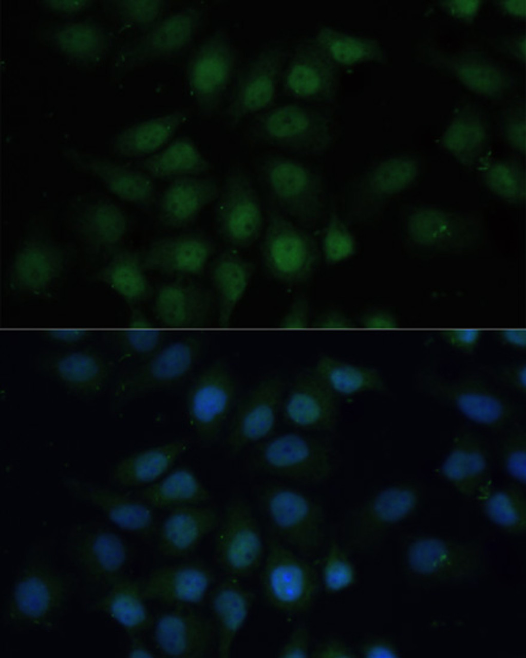 Immunofluorescence analysis of HeLa cells using CREB1 antibody (14-218) at dilution of 1:100. Blue: DAPI for nuclear staining.