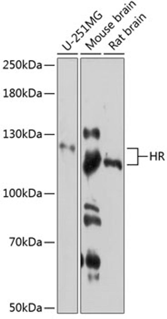 Western blot analysis of extracts of various cell lines, using HR antibody (14-220) at 1:3000 dilution.<br/>Secondary antibody: HRP Goat Anti-Rabbit IgG (H+L) at 1:10000 dilution.<br/>Lysates/proteins: 25ug per lane.<br/>Blocking buffer: 3% nonfat dry milk in TBST.<br/>Detection: ECL Enhanced Kit.<br/>Exposure time: 40s.