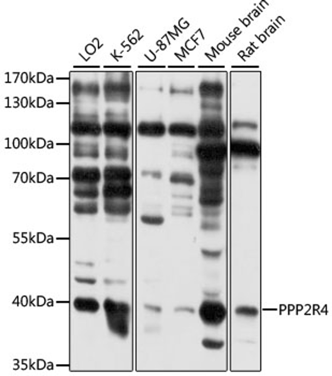 Western blot analysis of extracts of various cell lines, using PPP2R4 antibody (14-221) at 1:3000 dilution.<br/>Secondary antibody: HRP Goat Anti-Rabbit IgG (H+L) at 1:10000 dilution.<br/>Lysates/proteins: 25ug per lane.<br/>Blocking buffer: 3% nonfat dry milk in TBST.<br/>Detection: ECL Basic Kit.<br/>Exposure time: 20s.