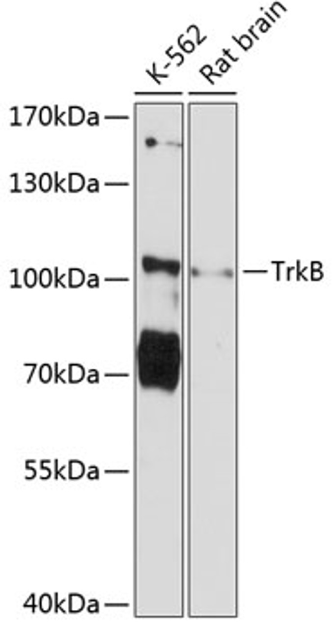 Western blot analysis of extracts of various cell lines, using TrkB Antibody (14-225) at 1:3000 dilution.<br/>Secondary antibody: HRP Goat Anti-Rabbit IgG (H+L) at 1:10000 dilution.<br/>Lysates/proteins: 25ug per lane.<br/>Blocking buffer: 3% nonfat dry milk in TBST.<br/>Detection: ECL Basic Kit.<br/>Exposure time: 30s.
