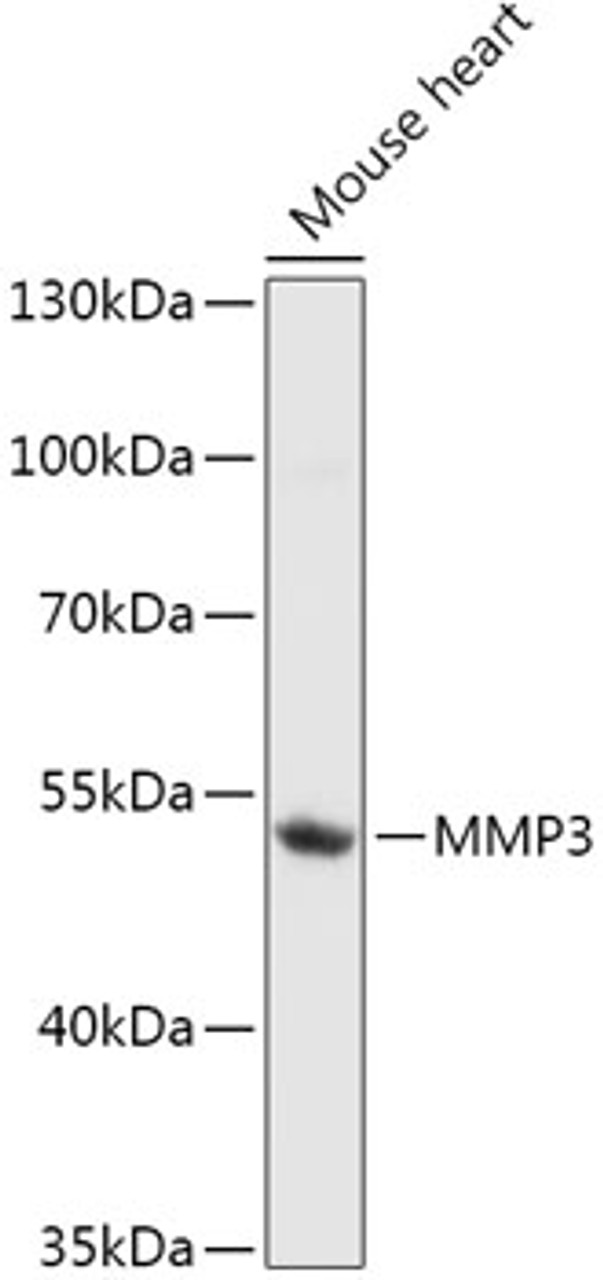 Western blot analysis of extracts of Mouse heart, using MMP3 antibody (14-227) at 1:1000 dilution.<br/>Secondary antibody: HRP Goat Anti-Rabbit IgG (H+L) at 1:10000 dilution.<br/>Lysates/proteins: 25ug per lane.<br/>Blocking buffer: 3% nonfat dry milk in TBST.<br/>Detection: ECL Basic Kit.<br/>Exposure time: 30s.