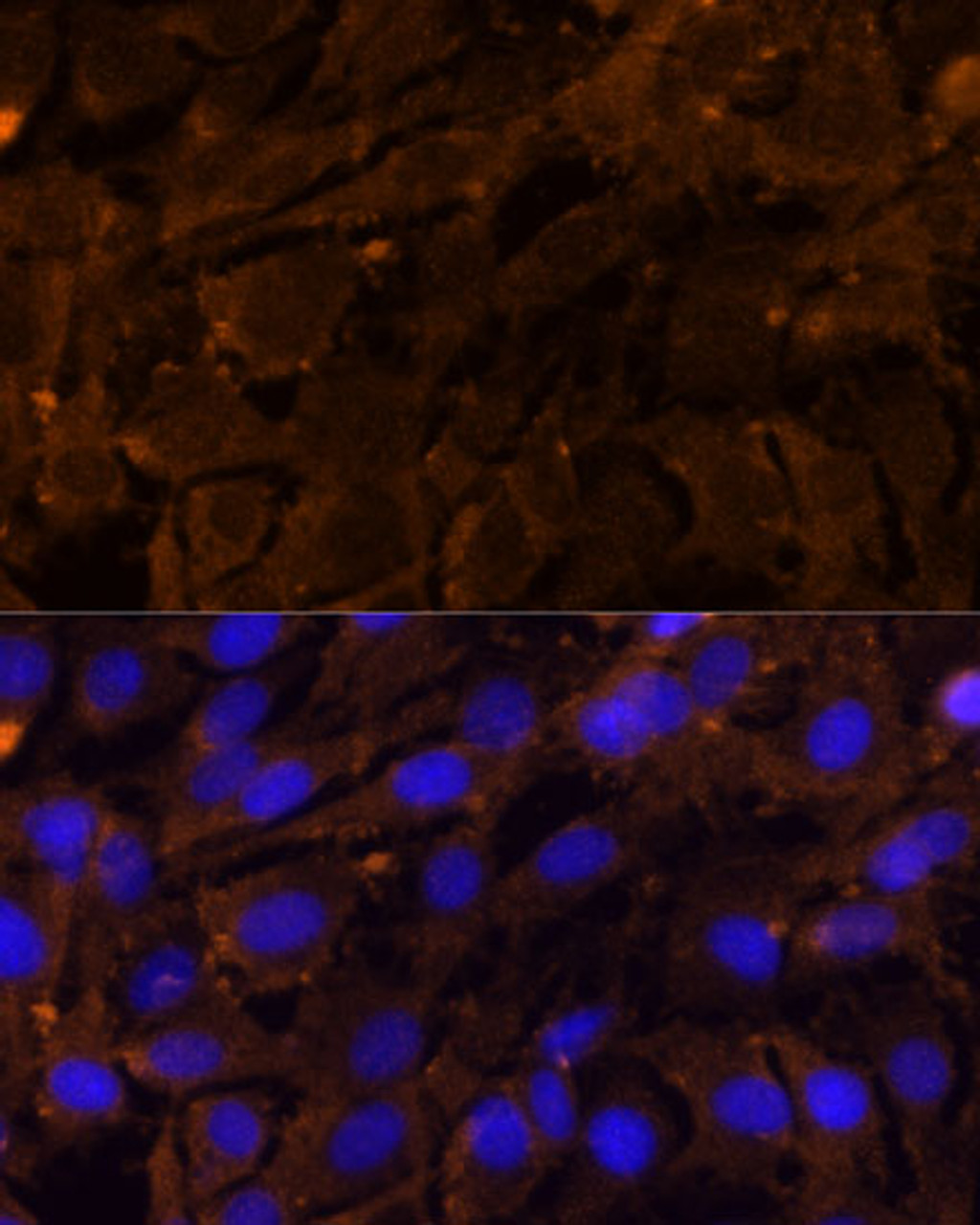 Immunofluorescence analysis of C6 cells using MMP3 Polyclonal Antibody (14-227) at dilution of 1:100 (40x lens) . Blue: DAPI for nuclear staining.