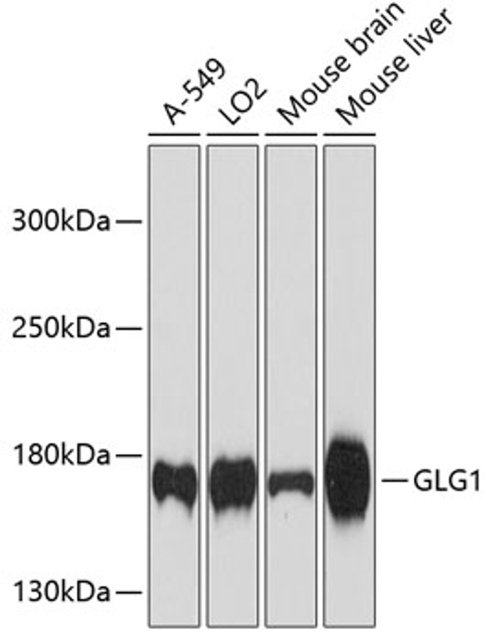 Western blot analysis of extracts of various cell lines, using GLG1 antibody (14-228) at 1:3000 dilution.<br/>Secondary antibody: HRP Goat Anti-Rabbit IgG (H+L) at 1:10000 dilution.<br/>Lysates/proteins: 25ug per lane.<br/>Blocking buffer: 3% nonfat dry milk in TBST.<br/>Detection: ECL Enhanced Kit.<br/>Exposure time: 90s.