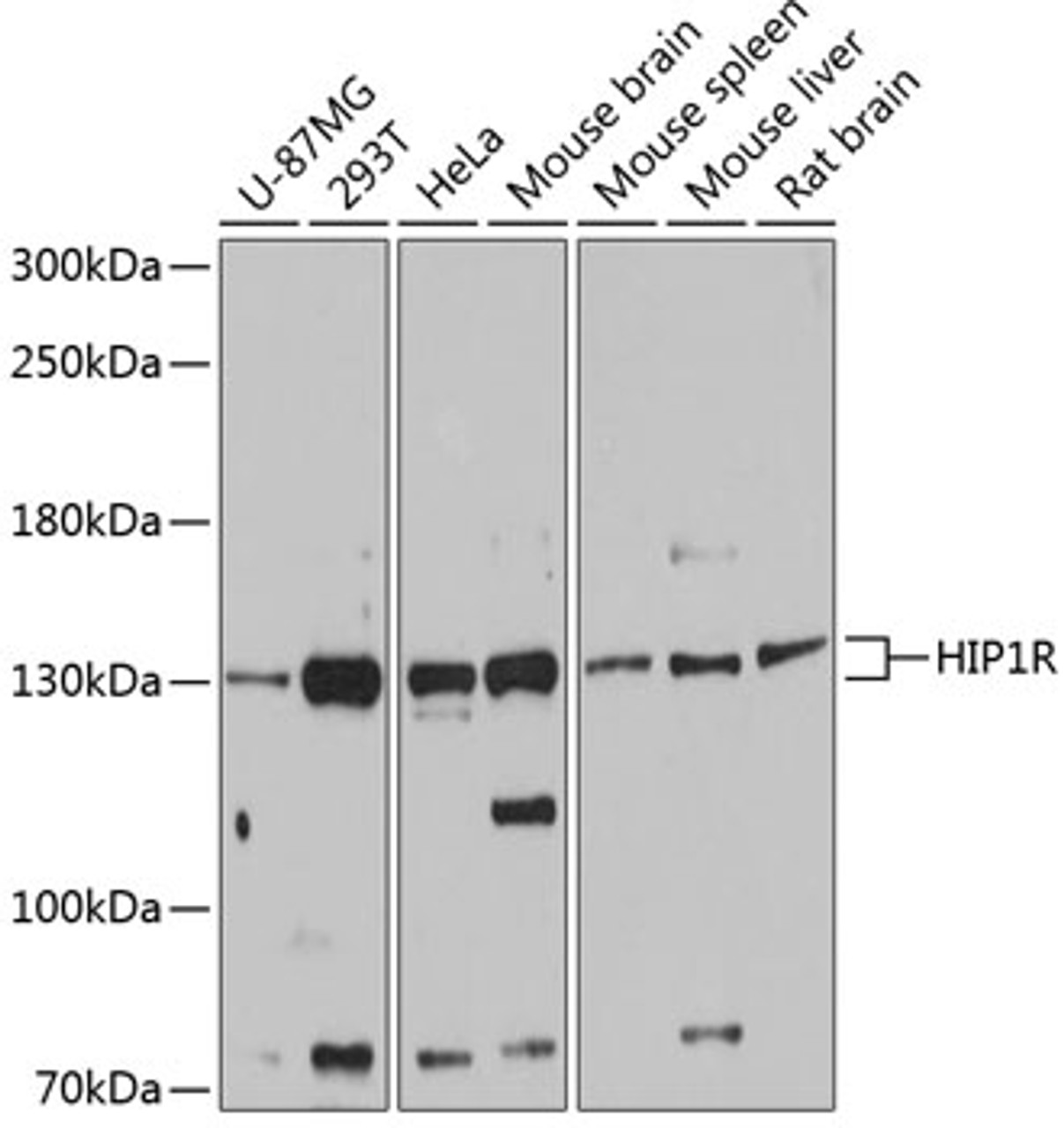 Western blot analysis of extracts of various cell lines, using HIP1R antibody (14-229) at 1:3000 dilution.<br/>Secondary antibody: HRP Goat Anti-Rabbit IgG (H+L) at 1:10000 dilution.<br/>Lysates/proteins: 25ug per lane.<br/>Blocking buffer: 3% nonfat dry milk in TBST.<br/>Detection: ECL Basic Kit.<br/>Exposure time: 60s.