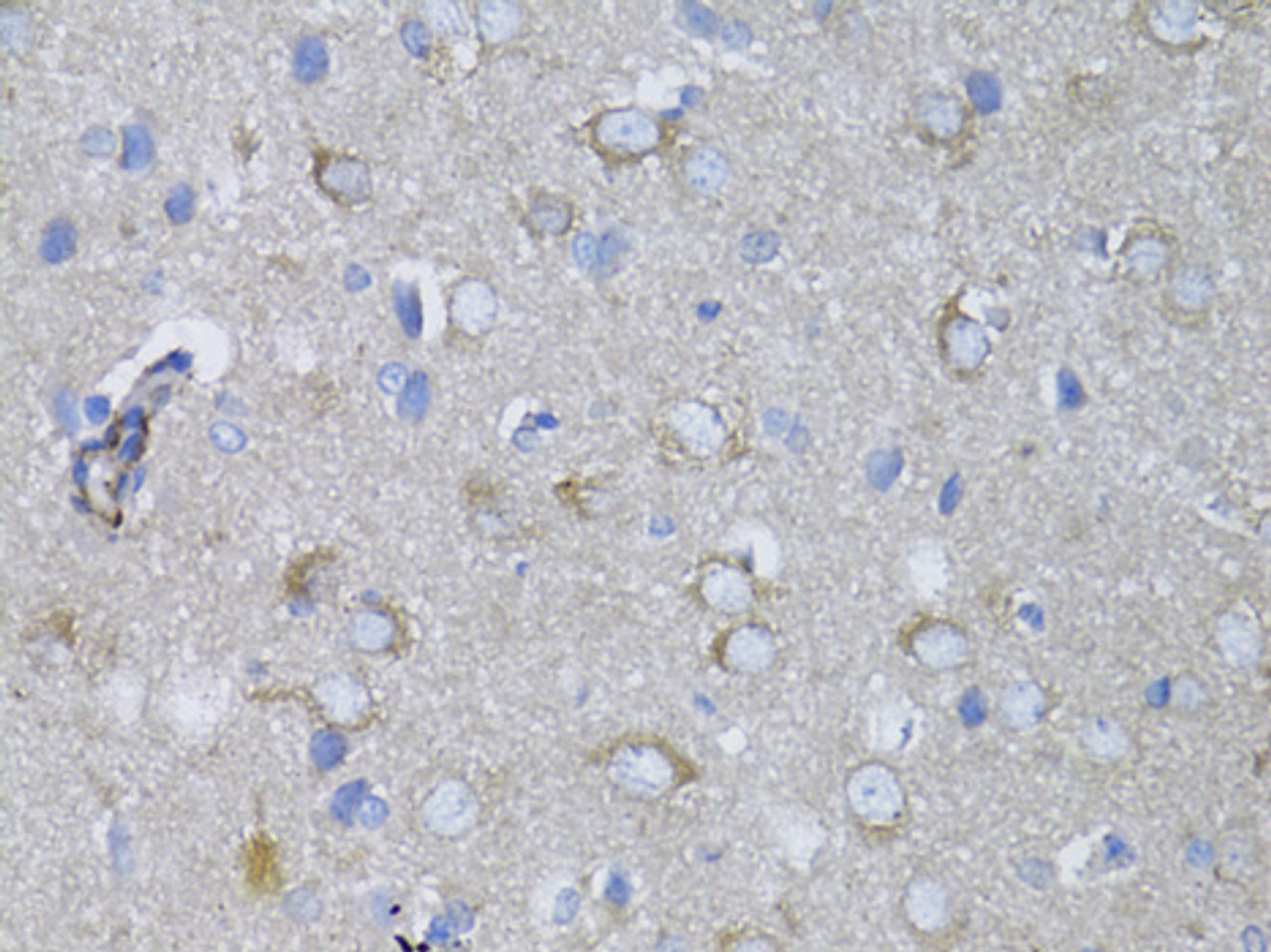 Immunohistochemistry of paraffin-embedded rat brain using MYH10 antibody (14-230) at dilution of 1:100 (40x lens) .