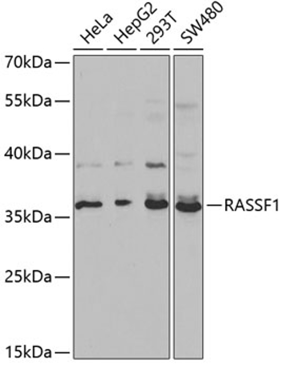 Western blot analysis of extracts of various cell lines, using RASSF1 antibody (14-231) at 1:1000 dilution.<br/>Secondary antibody: HRP Goat Anti-Rabbit IgG (H+L) at 1:10000 dilution.<br/>Lysates/proteins: 25ug per lane.<br/>Blocking buffer: 3% nonfat dry milk in TBST.