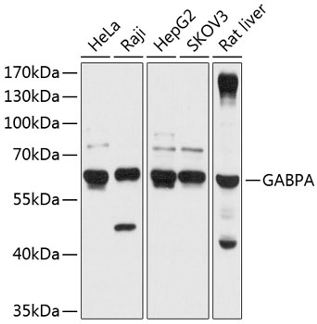 Western blot analysis of extracts of various cell lines, using GABPA antibody (14-238) at 1:1000 dilution.<br/>Secondary antibody: HRP Goat Anti-Rabbit IgG (H+L) at 1:10000 dilution.<br/>Lysates/proteins: 25ug per lane.<br/>Blocking buffer: 3% nonfat dry milk in TBST.<br/>Detection: ECL Basic Kit.<br/>Exposure time: 1s.