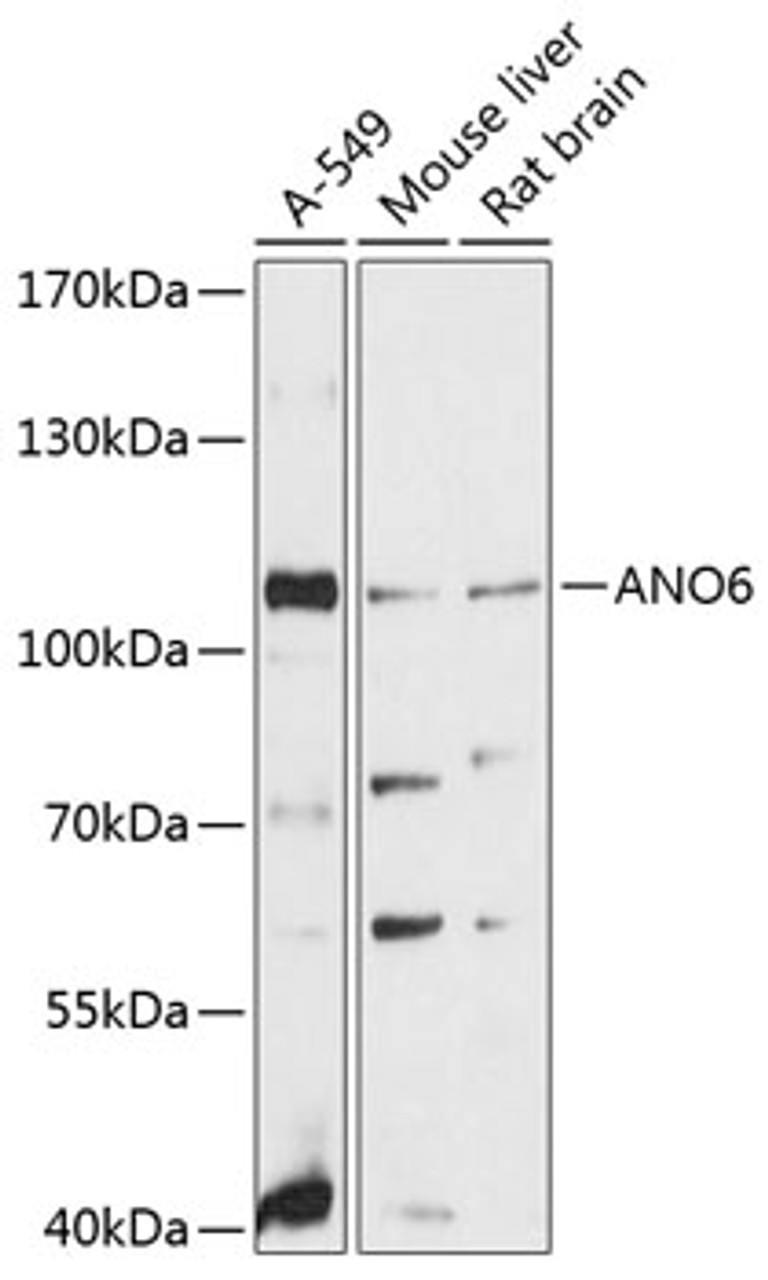 Western blot analysis of extracts of various cell lines, using ANO6 antibody (14-239) at 1:3000 dilution.<br/>Secondary antibody: HRP Goat Anti-Rabbit IgG (H+L) at 1:10000 dilution.<br/>Lysates/proteins: 25ug per lane.<br/>Blocking buffer: 3% nonfat dry milk in TBST.<br/>Detection: ECL Basic Kit.<br/>Exposure time: 90s.