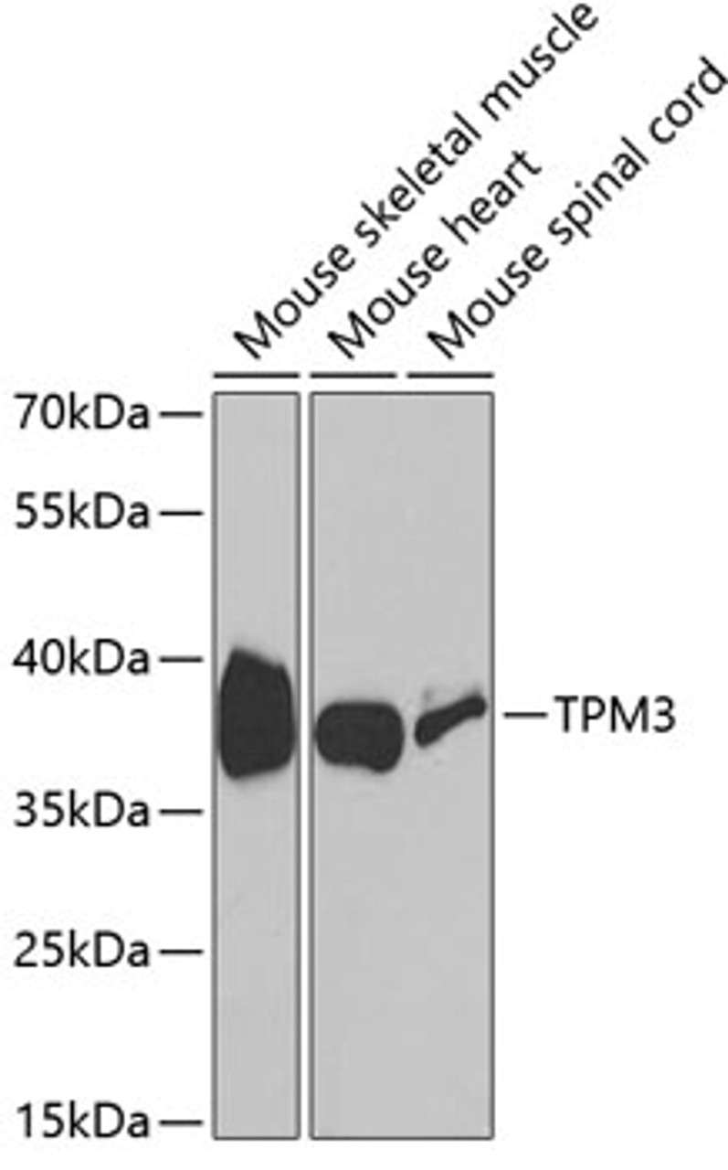 Western blot analysis of extracts of various cell lines, using TPM3 antibody (14-242) at 1:1000 dilution.<br/>Secondary antibody: HRP Goat Anti-Rabbit IgG (H+L) at 1:10000 dilution.<br/>Lysates/proteins: 25ug per lane.<br/>Blocking buffer: 3% nonfat dry milk in TBST.