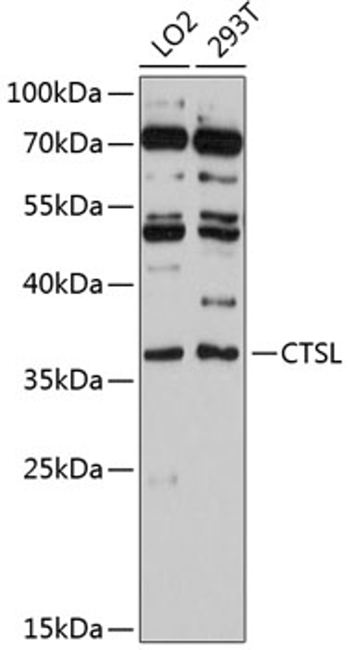 Western blot analysis of extracts of various cell lines, using CTSL antibody (14-245) at 1:3000 dilution.<br/>Secondary antibody: HRP Goat Anti-Rabbit IgG (H+L) at 1:10000 dilution.<br/>Lysates/proteins: 25ug per lane.<br/>Blocking buffer: 3% nonfat dry milk in TBST.<br/>Detection: ECL Basic Kit.<br/>Exposure time: 90s.