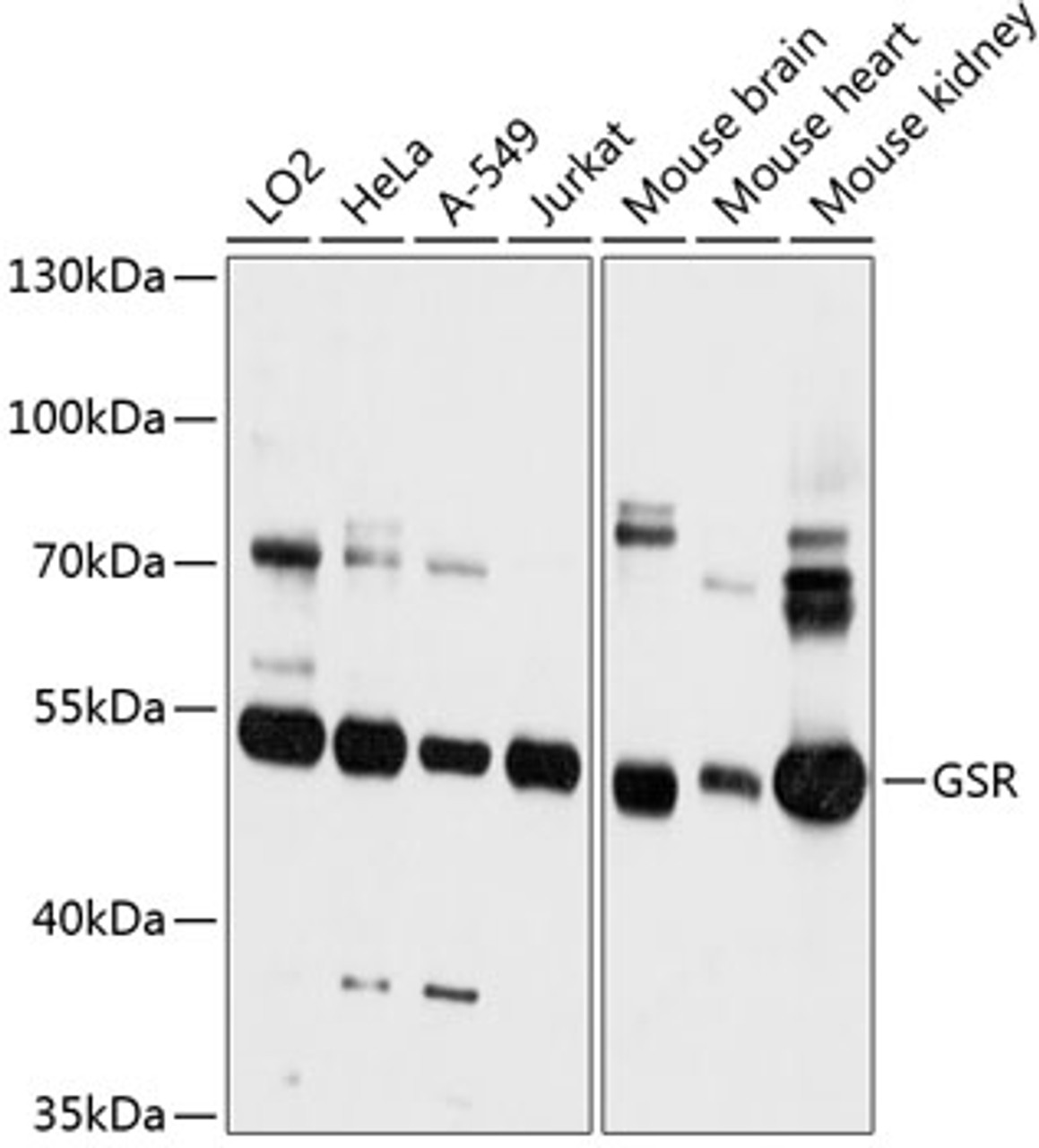 Western blot analysis of extracts of various cell lines, using GSR antibody (14-247) at 1:3000 dilution.<br/>Secondary antibody: HRP Goat Anti-Rabbit IgG (H+L) at 1:10000 dilution.<br/>Lysates/proteins: 25ug per lane.<br/>Blocking buffer: 3% nonfat dry milk in TBST.<br/>Detection: ECL Basic Kit.<br/>Exposure time: 10s.