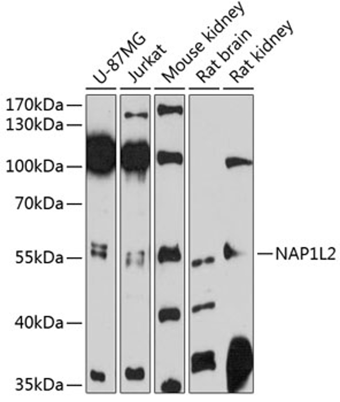 Western blot analysis of extracts of various cell lines, using NAP1L2 antibody (14-254) at 1:3000 dilution.<br/>Secondary antibody: HRP Goat Anti-Rabbit IgG (H+L) at 1:10000 dilution.<br/>Lysates/proteins: 25ug per lane.<br/>Blocking buffer: 3% nonfat dry milk in TBST.<br/>Detection: ECL Enhanced Kit.<br/>Exposure time: 90s.