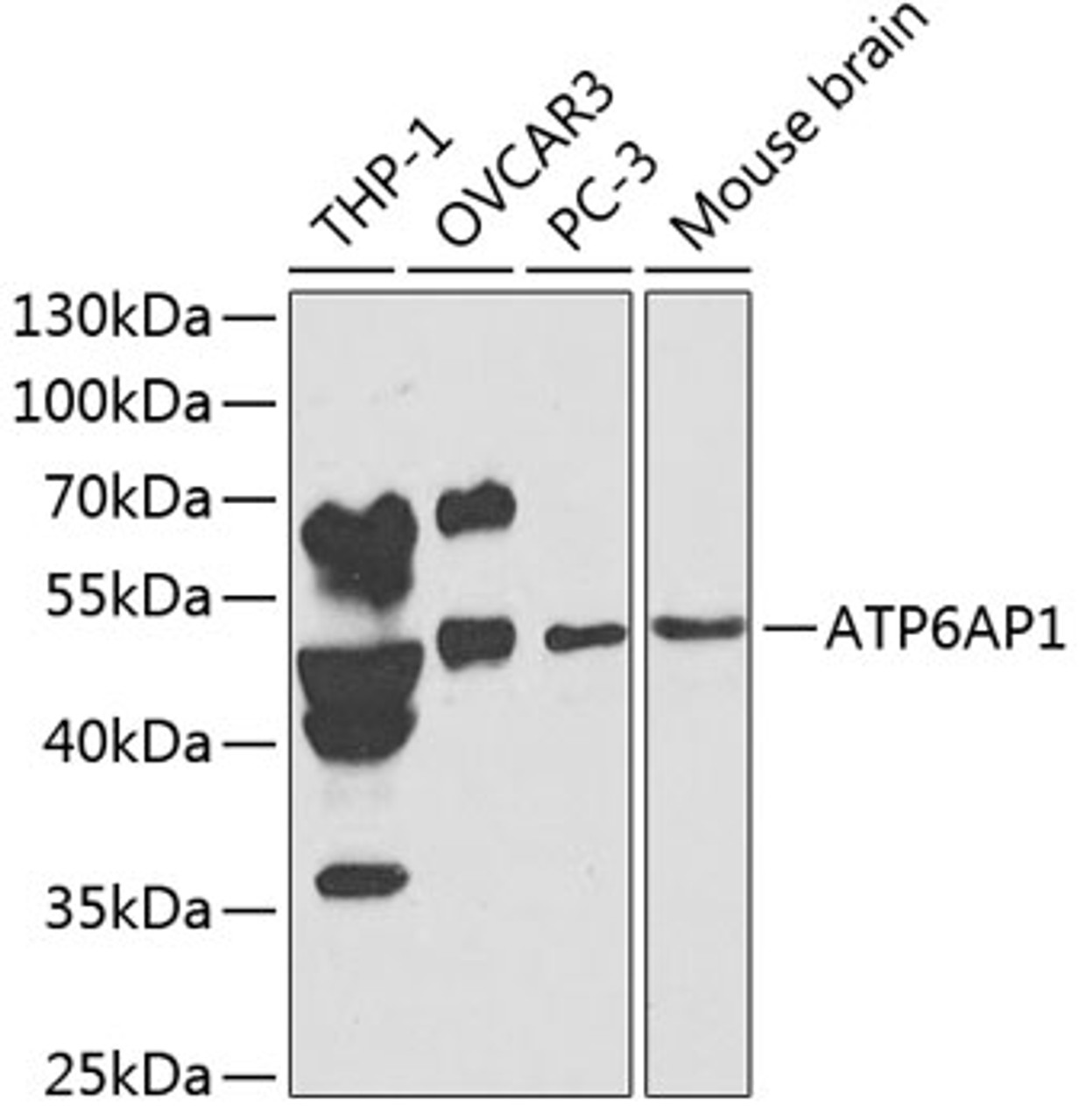 Western blot analysis of extracts of various cell lines, using ATP6AP1 antibody (14-256) at 1:1000 dilution.<br/>Secondary antibody: HRP Goat Anti-Rabbit IgG (H+L) at 1:10000 dilution.<br/>Lysates/proteins: 25ug per lane.<br/>Blocking buffer: 3% nonfat dry milk in TBST.