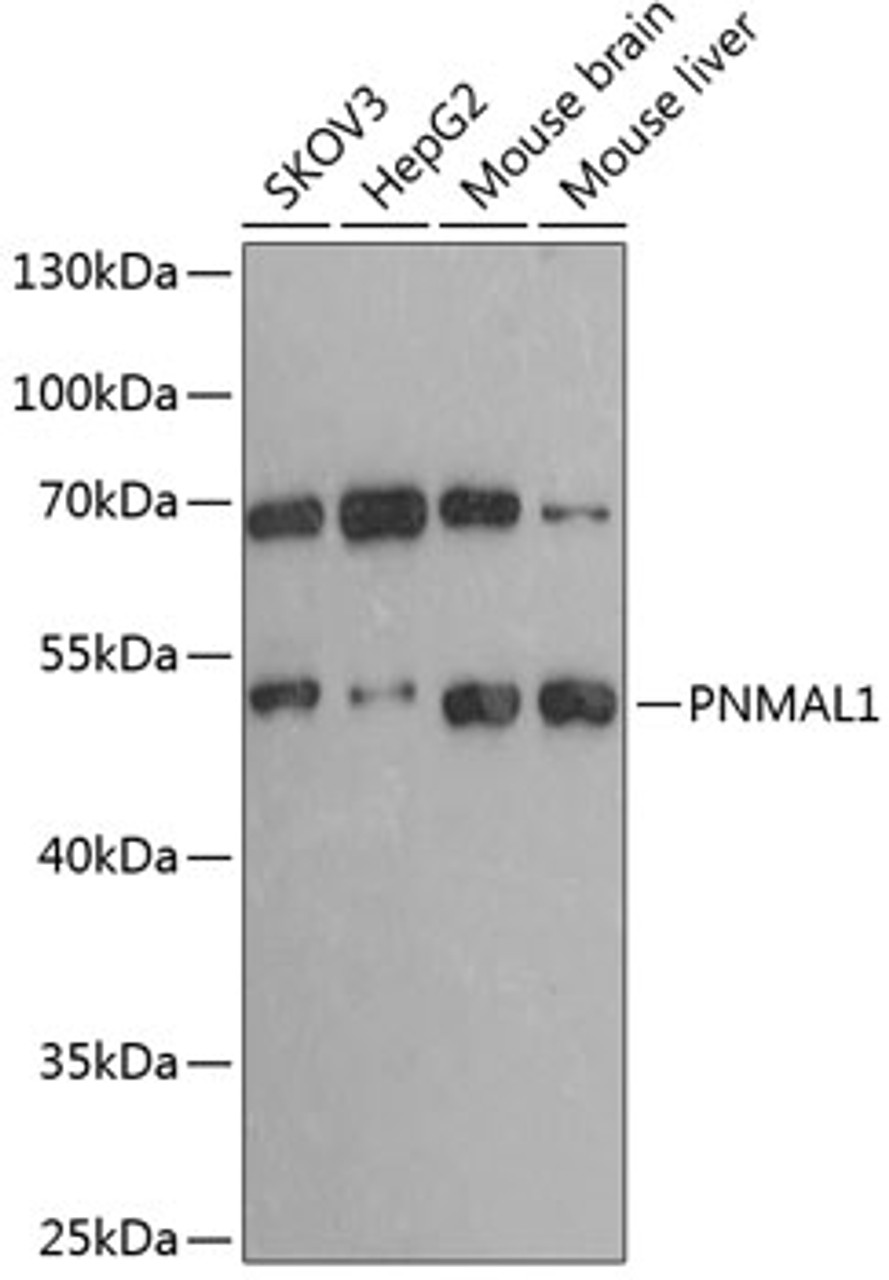 Western blot analysis of extracts of various cell lines, using PNMAL1 antibody (14-257) at 1:3000 dilution.<br/>Secondary antibody: HRP Goat Anti-Rabbit IgG (H+L) at 1:10000 dilution.<br/>Lysates/proteins: 25ug per lane.<br/>Blocking buffer: 3% nonfat dry milk in TBST.<br/>Detection: ECL Basic Kit.<br/>Exposure time: 60s.