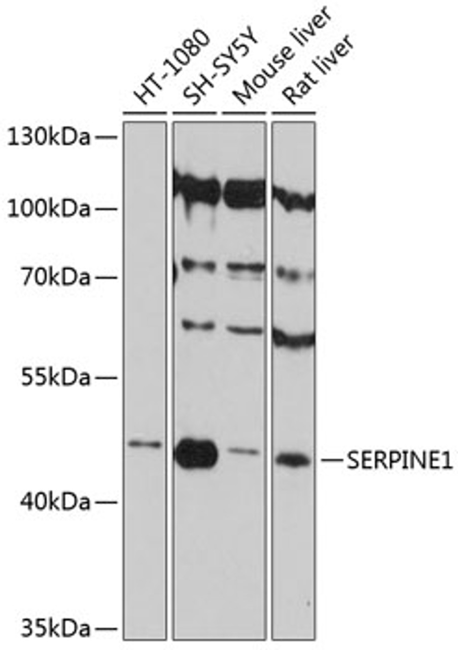 Western blot analysis of extracts of various cell lines, using SERPINE1 antibody (14-262) at 1:3000 dilution.<br/>Secondary antibody: HRP Goat Anti-Rabbit IgG (H+L) at 1:10000 dilution.<br/>Lysates/proteins: 25ug per lane.<br/>Blocking buffer: 3% nonfat dry milk in TBST.<br/>Detection: ECL Basic Kit.<br/>Exposure time: 40s.