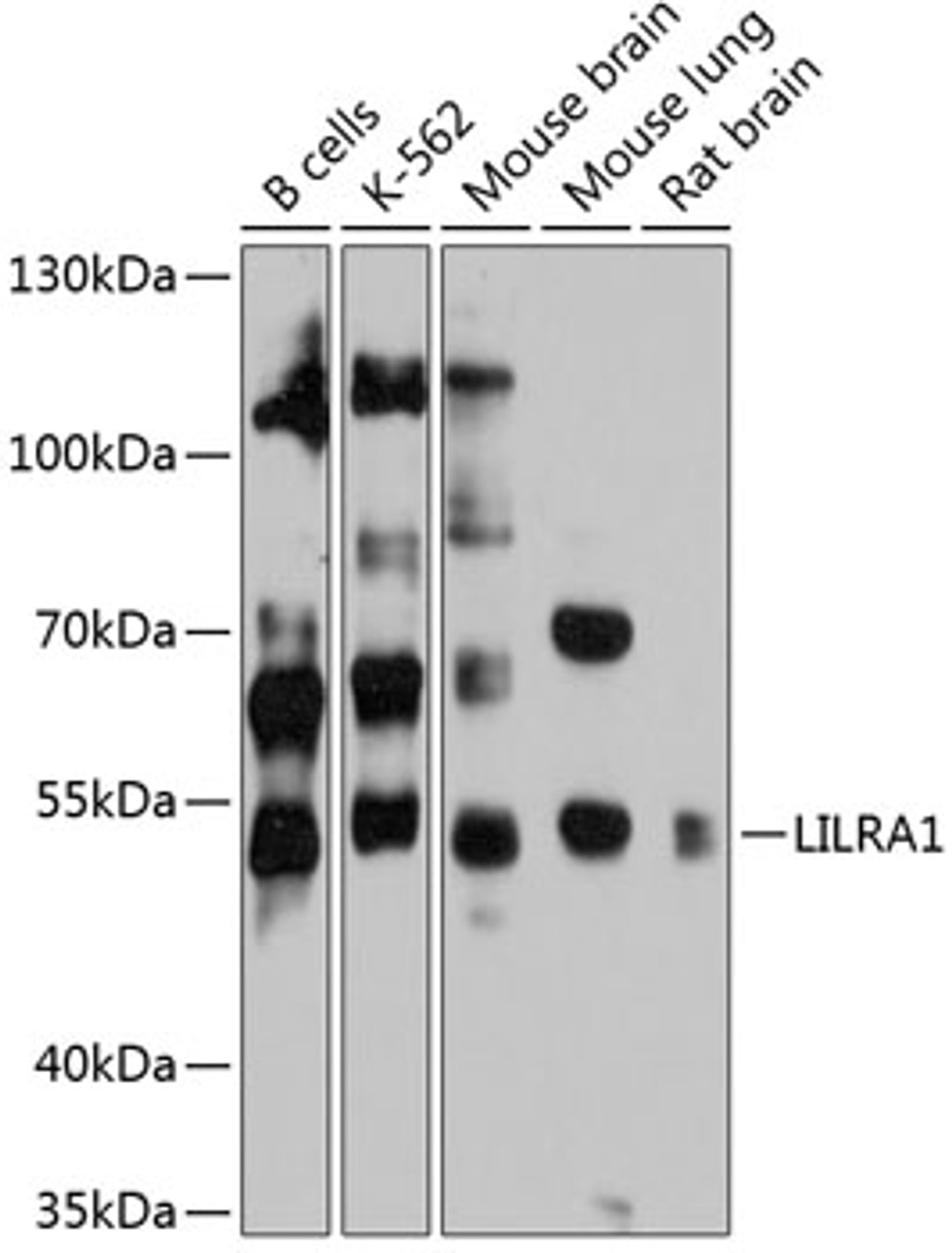 Western blot analysis of extracts of various cell lines, using LILRA1 antibody (14-264) at 1:3000 dilution.<br/>Secondary antibody: HRP Goat Anti-Rabbit IgG (H+L) at 1:10000 dilution.<br/>Lysates/proteins: 25ug per lane.<br/>Blocking buffer: 3% nonfat dry milk in TBST.<br/>Detection: ECL Basic Kit.<br/>Exposure time: 60s.