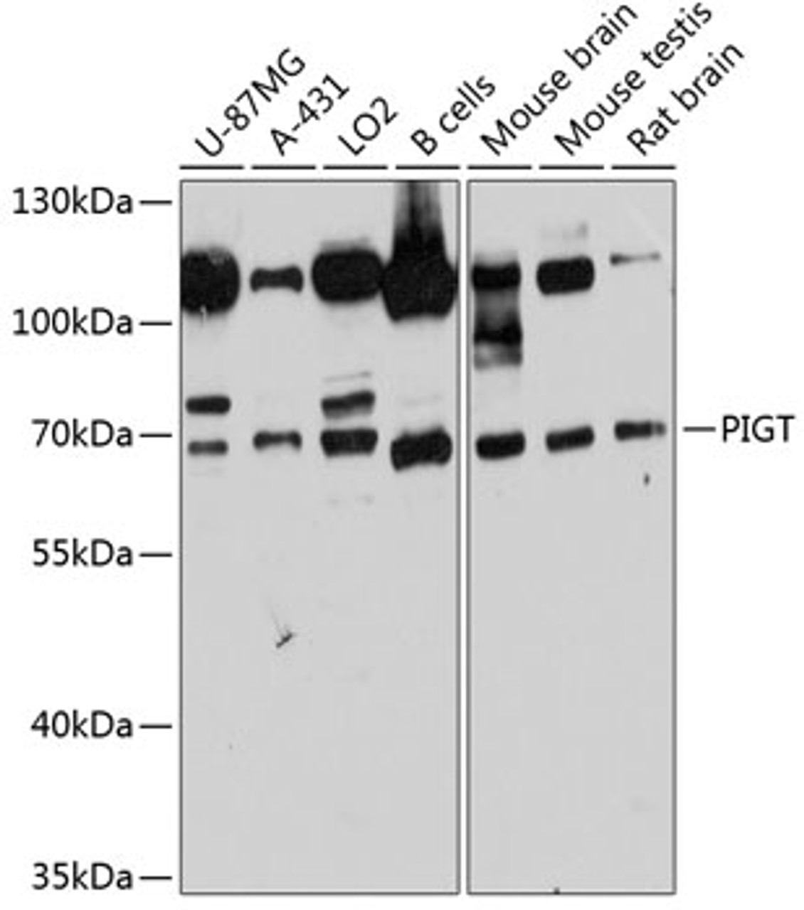 Western blot analysis of extracts of various cell lines, using PIGT antibody (14-266) at 1:3000 dilution.<br/>Secondary antibody: HRP Goat Anti-Rabbit IgG (H+L) at 1:10000 dilution.<br/>Lysates/proteins: 25ug per lane.<br/>Blocking buffer: 3% nonfat dry milk in TBST.<br/>Detection: ECL Basic Kit.<br/>Exposure time: 60s.