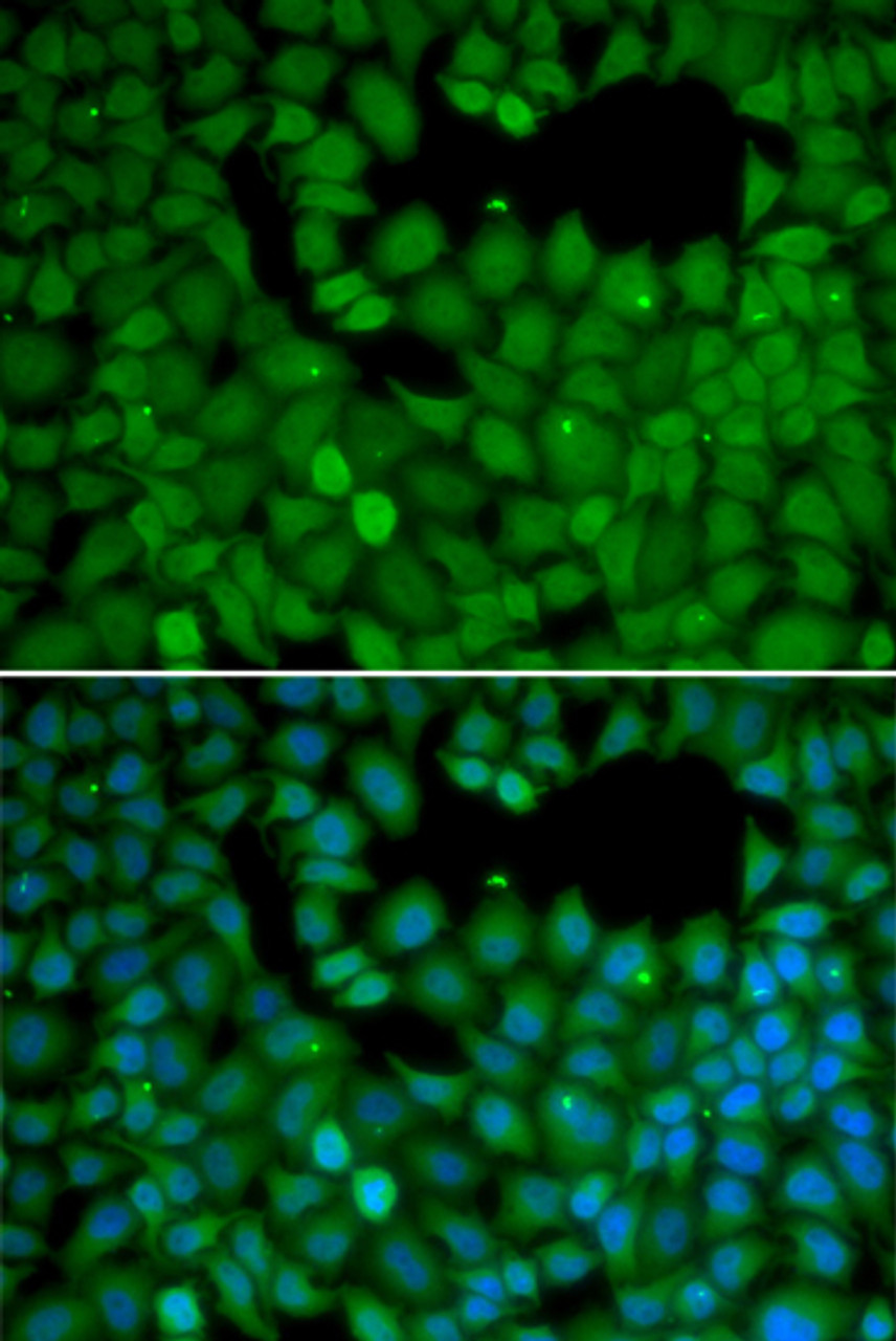 Immunofluorescence analysis of HeLa cells using NET1 antibody (14-270) . Blue: DAPI for nuclear staining.