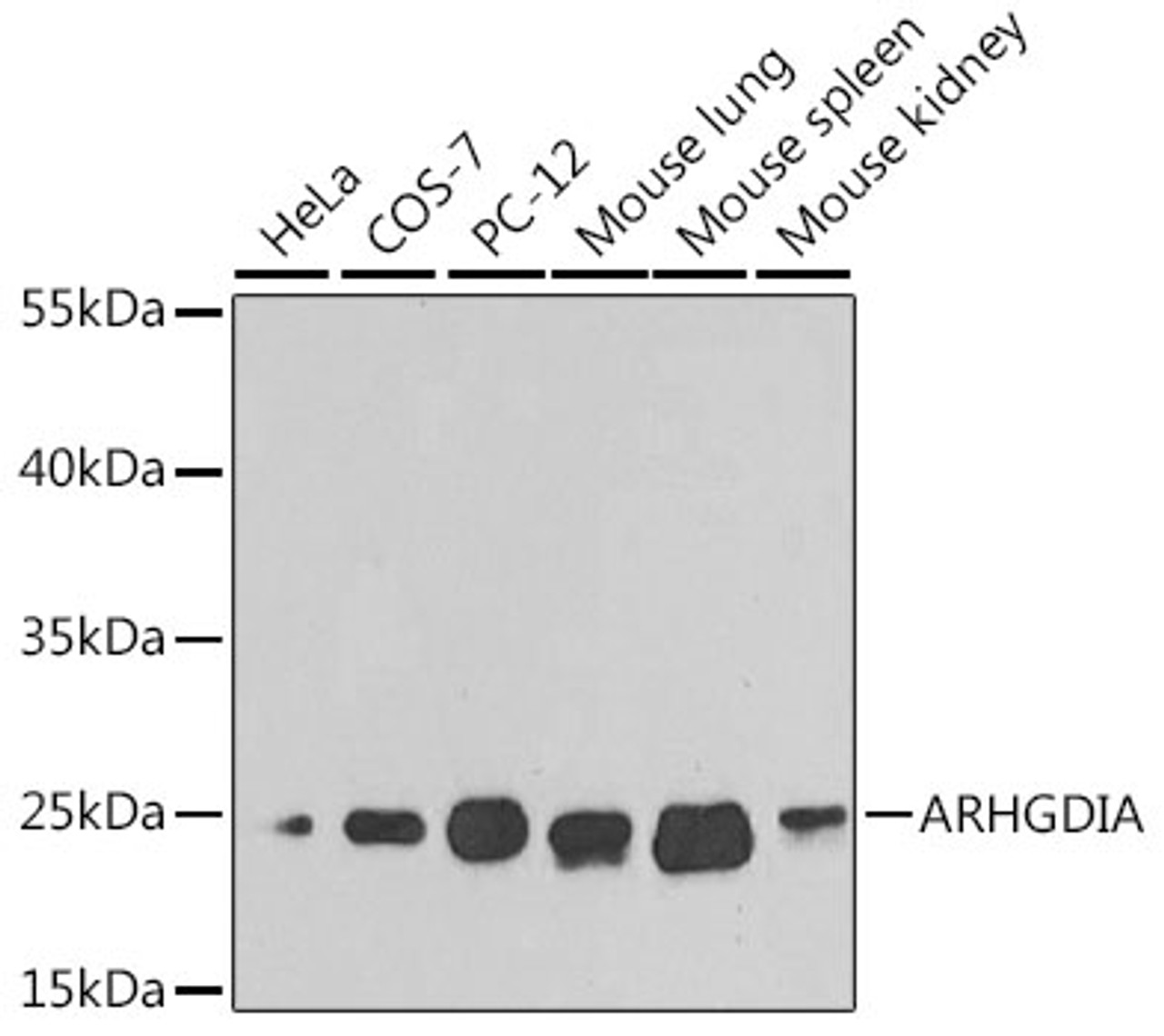 Western blot analysis of extracts of various cell lines, using ARHGDIA antibody (14-275) at 1:1000 dilution.<br/>Secondary antibody: HRP Goat Anti-Rabbit IgG (H+L) at 1:10000 dilution.<br/>Lysates/proteins: 25ug per lane.<br/>Blocking buffer: 3% nonfat dry milk in TBST.